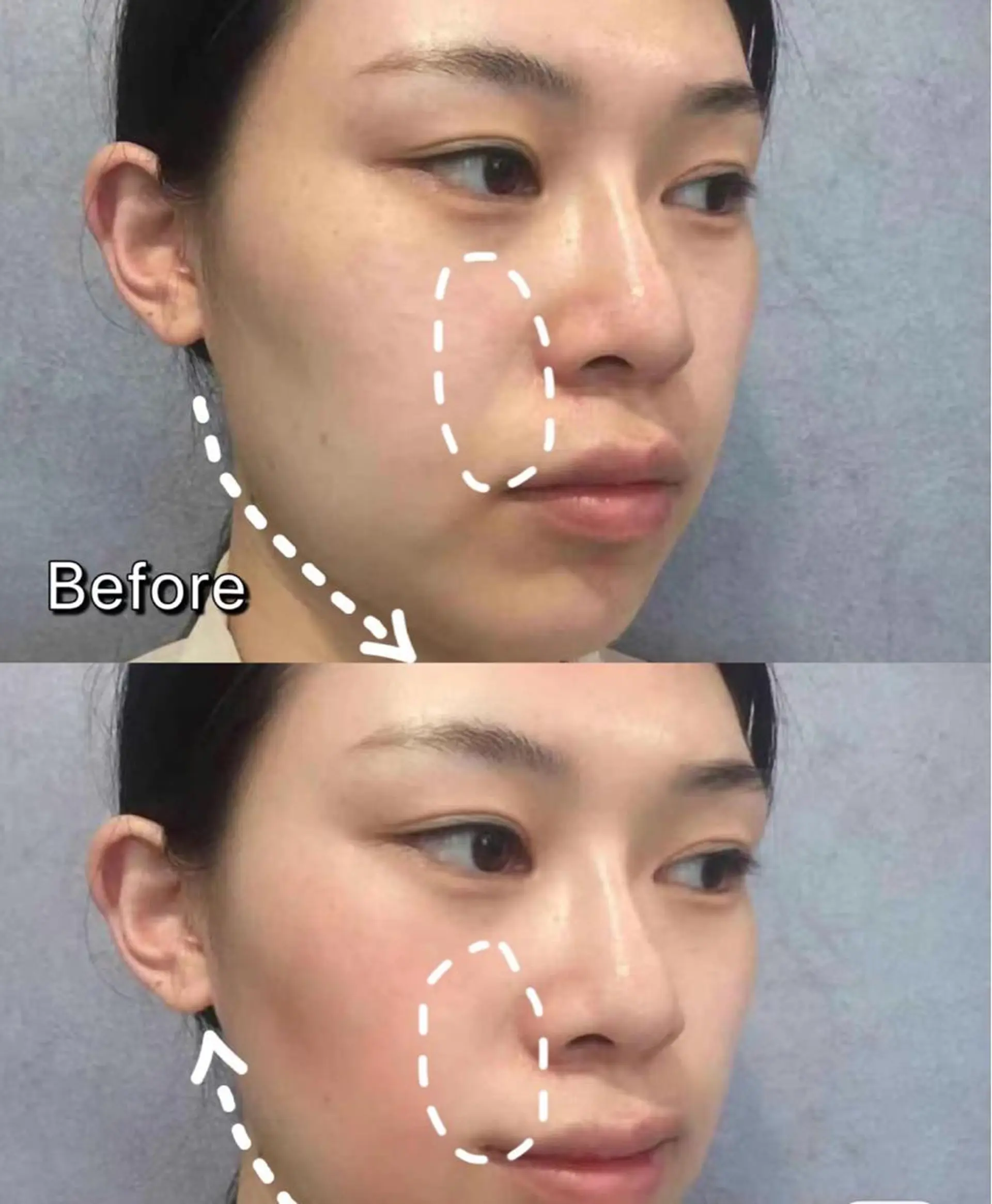 エステ aliaハイフ&水光ジェットサロン所属・aliaハーブ水光店 エステティシャン募集のエステ・リラクイメージ