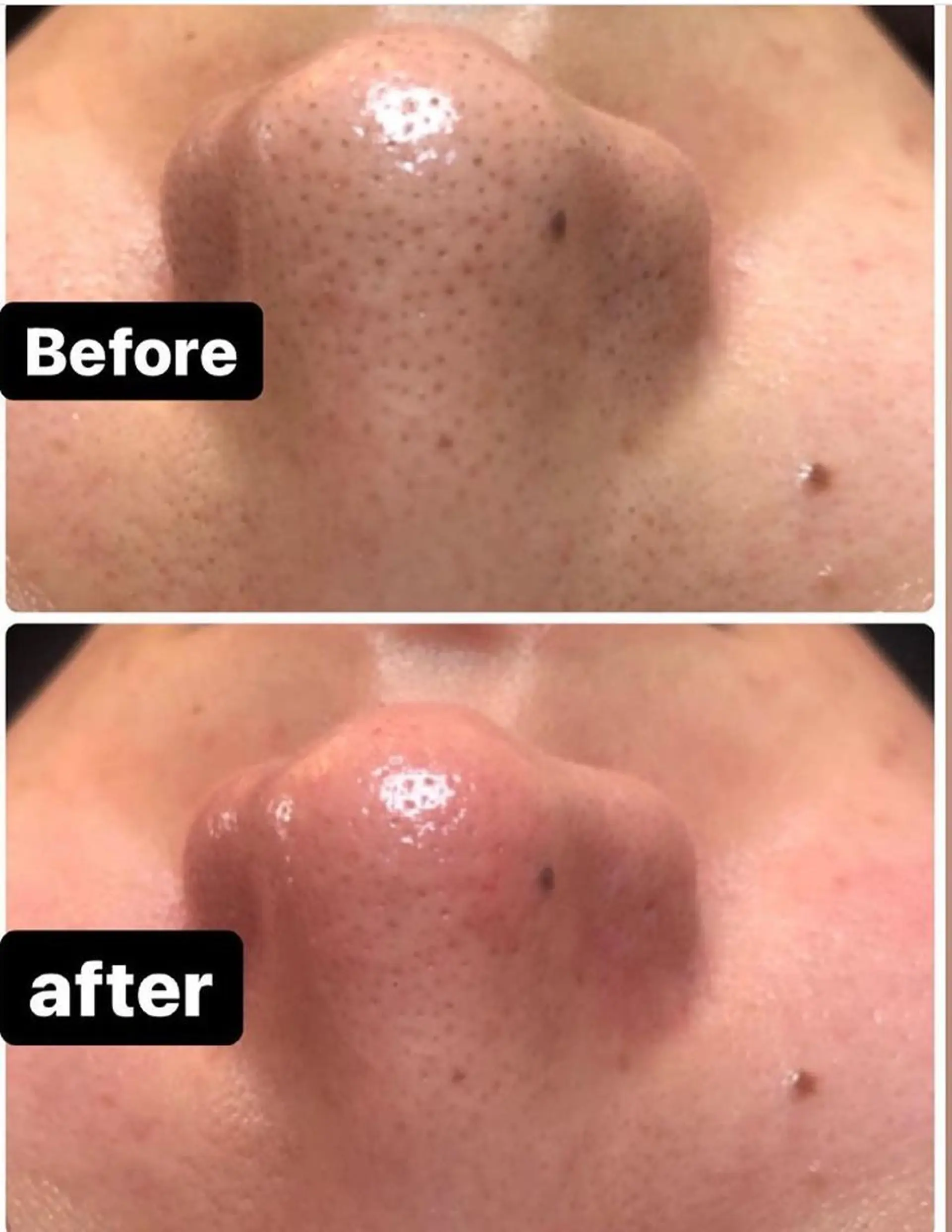 エステ 美顔秘密基地新宮所属・美顔秘密基地 新宮のその他イメージ