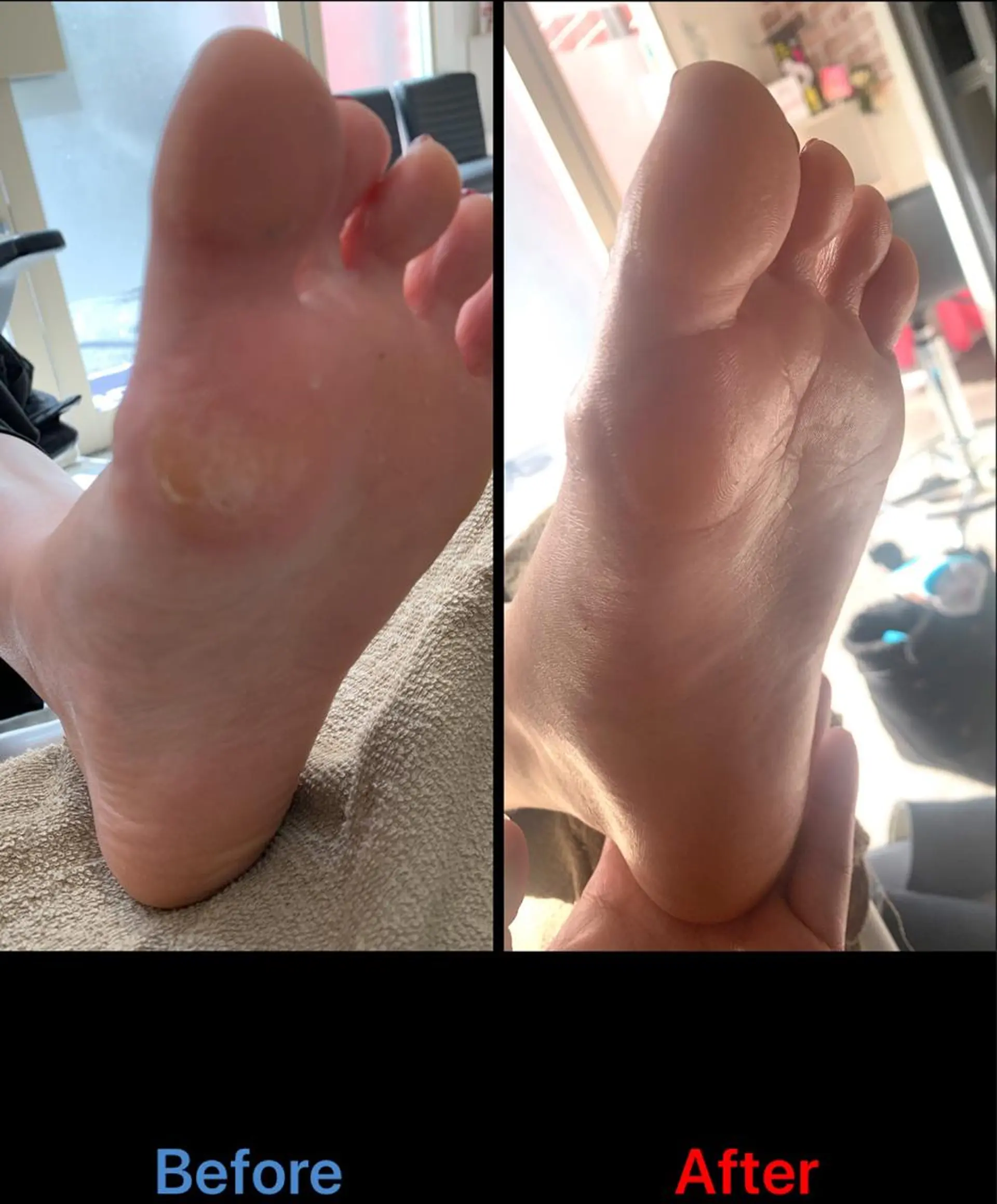 ネイル 毛穴改善/脱毛 ネイル 川上久仁子のエステ・リラクイメージ