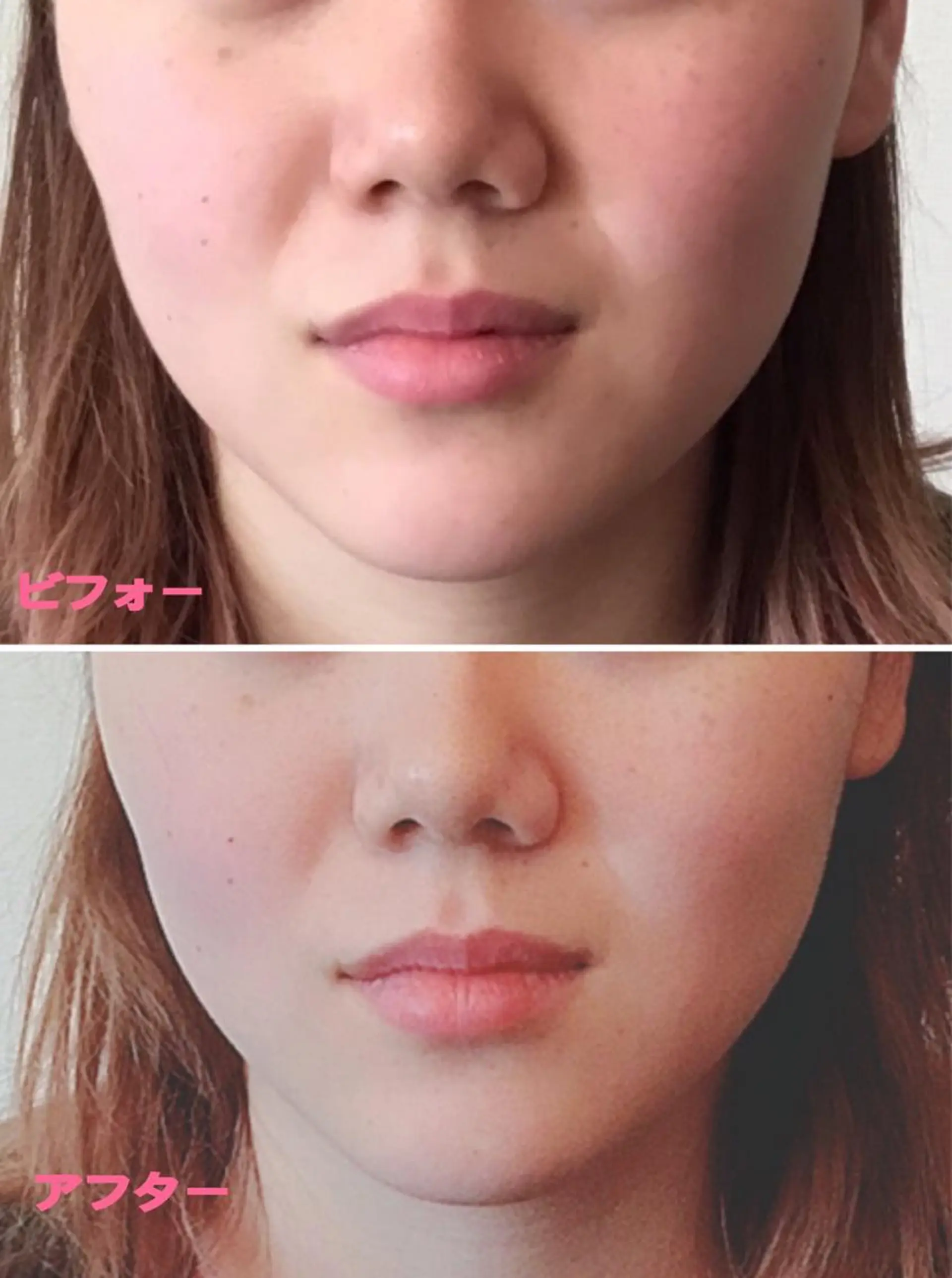 小顔サロン ソ.ルシエのエステ・リラクイメージ