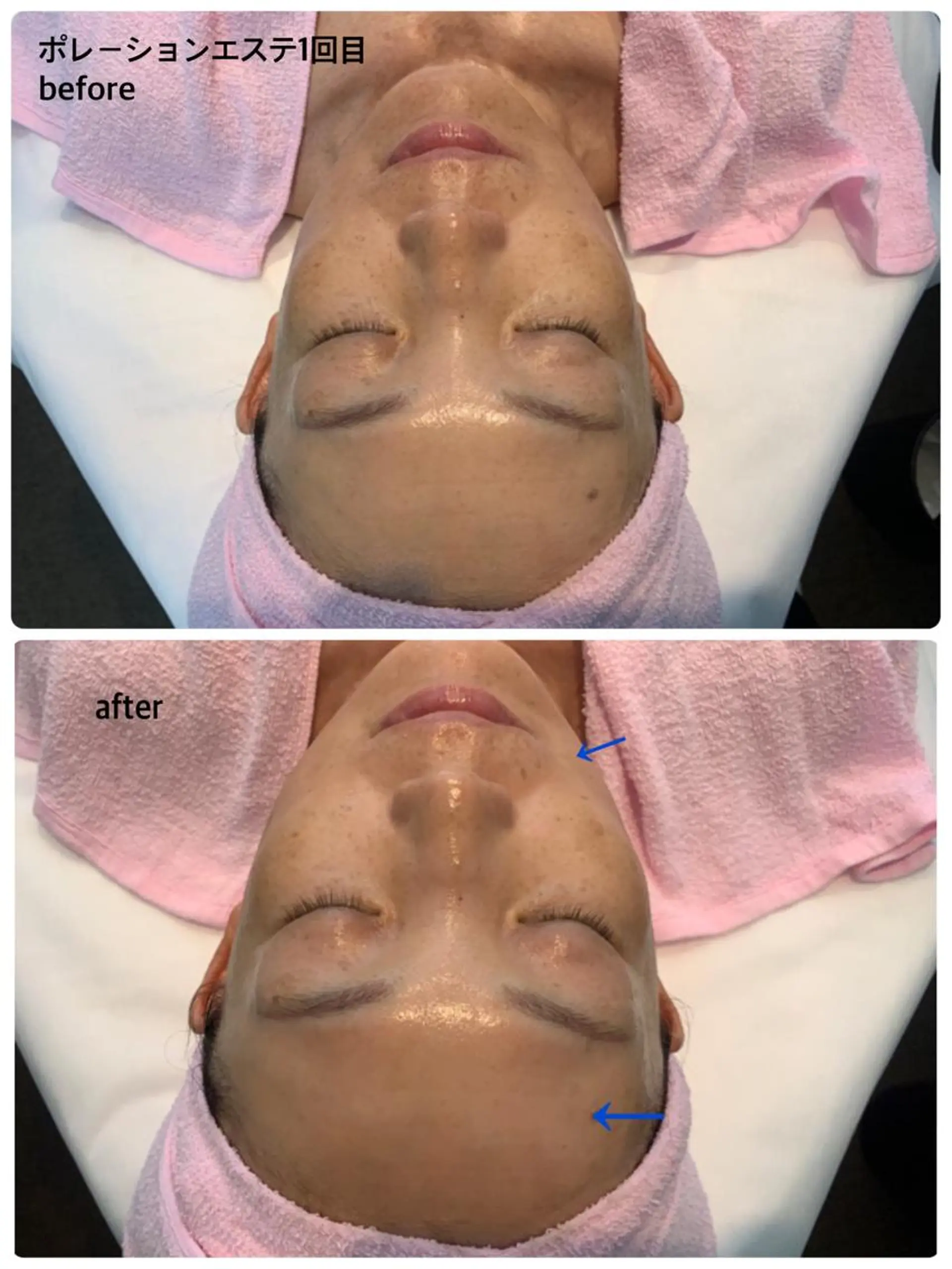 リラクゼーションエステサロン🌺肌質改善イアリイ所属・肌質再生 〜イア🌺リイ〜のエステ・リラクイメージ