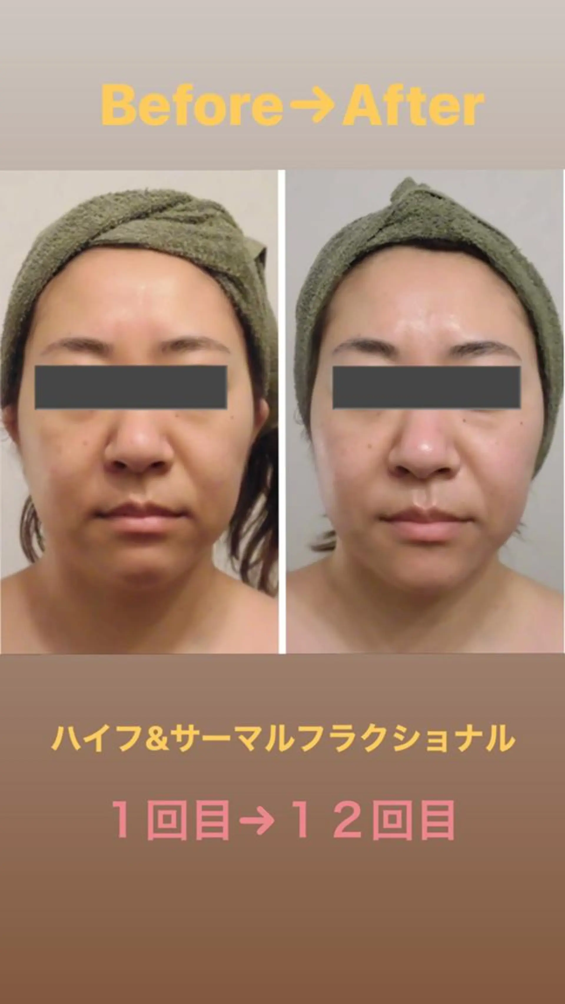 痩身専門店 イオンモール春日部店のエステ・リラクイメージ