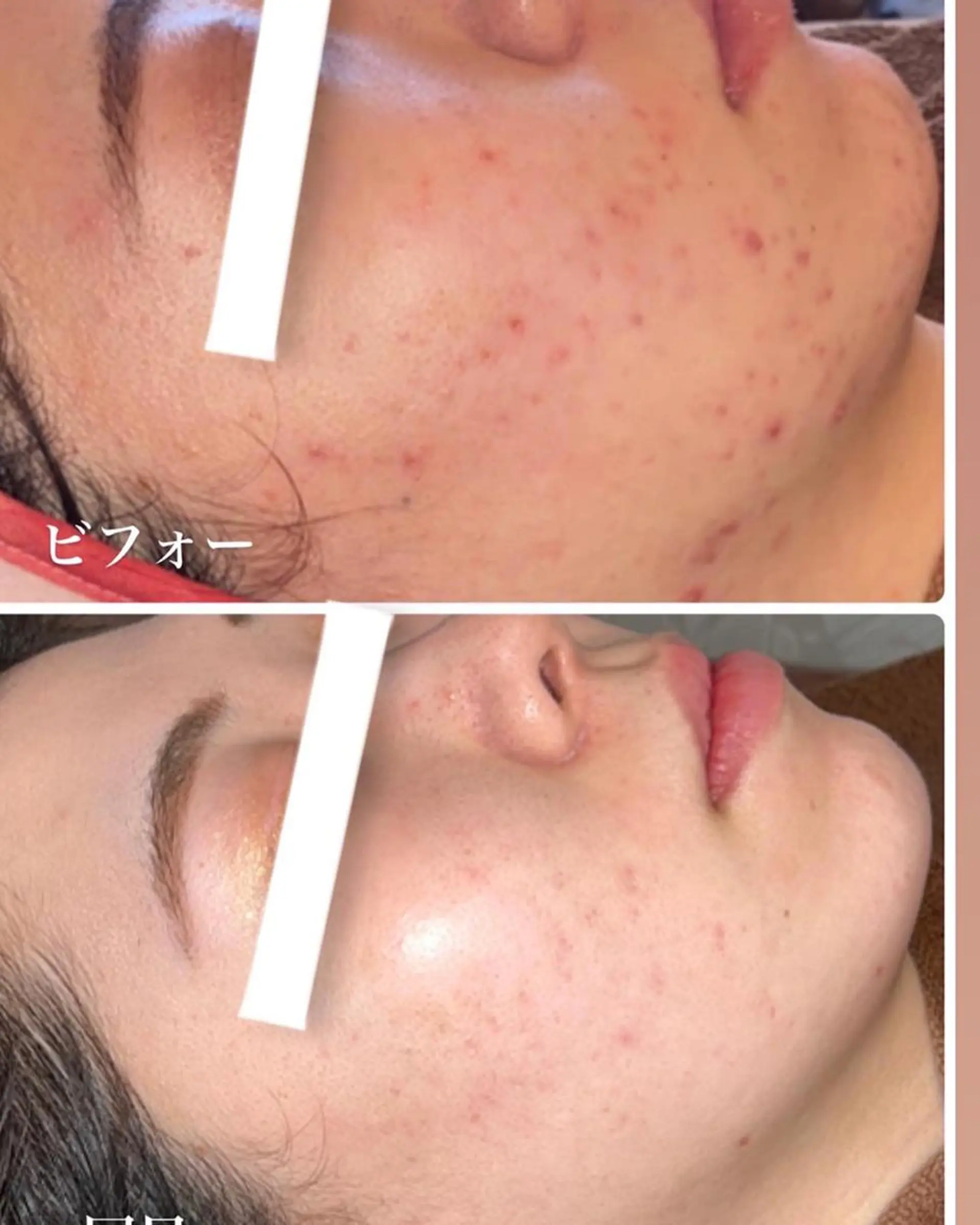 エステ FLEURフェイシャ ル🫧ハーブ🌿小顔のエステ・リラクイメージ