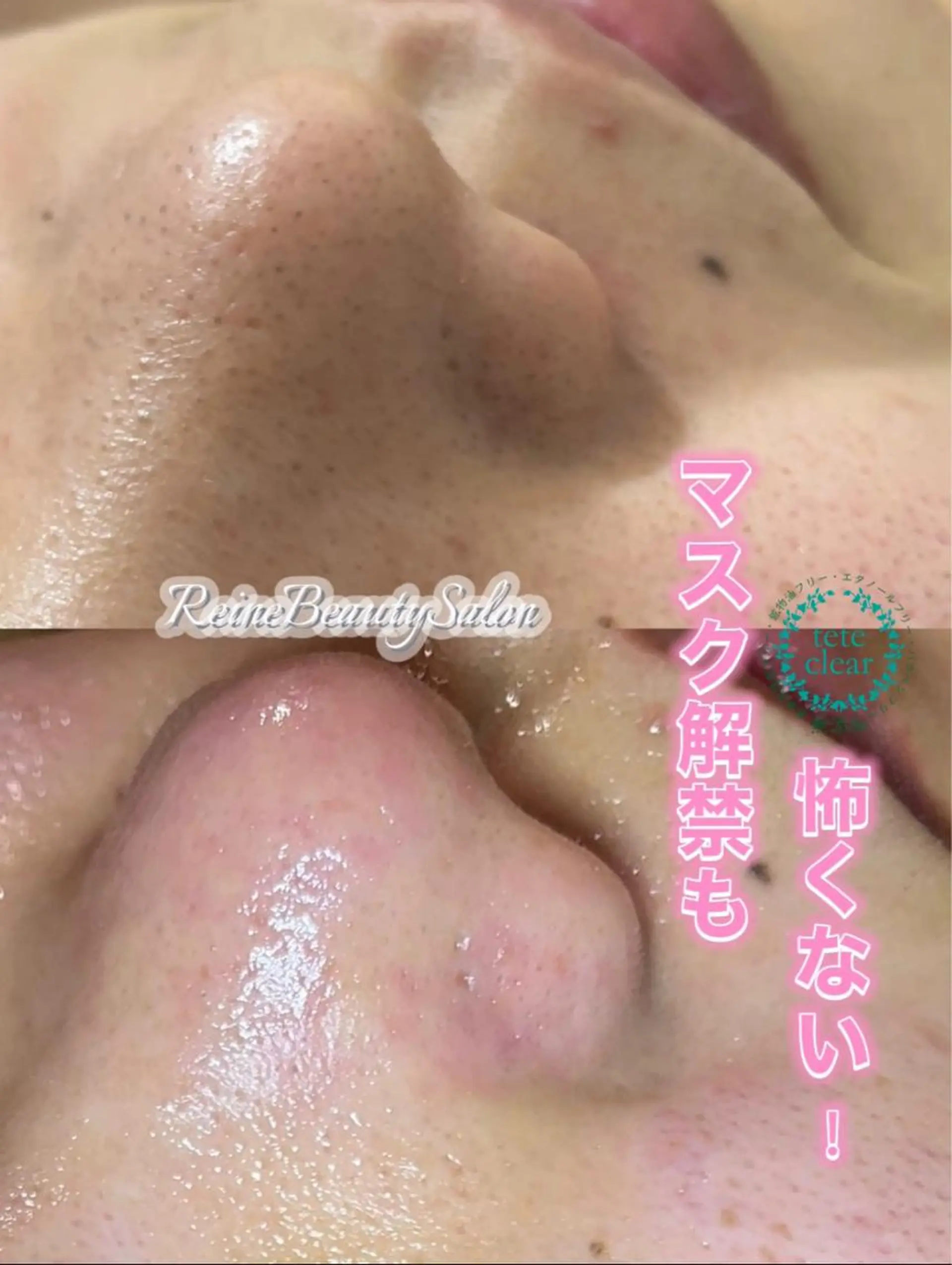 Reine BeautySalon所属・毛穴/シミ肝斑/脱毛 横山梨里のエステ・リラクイメージ