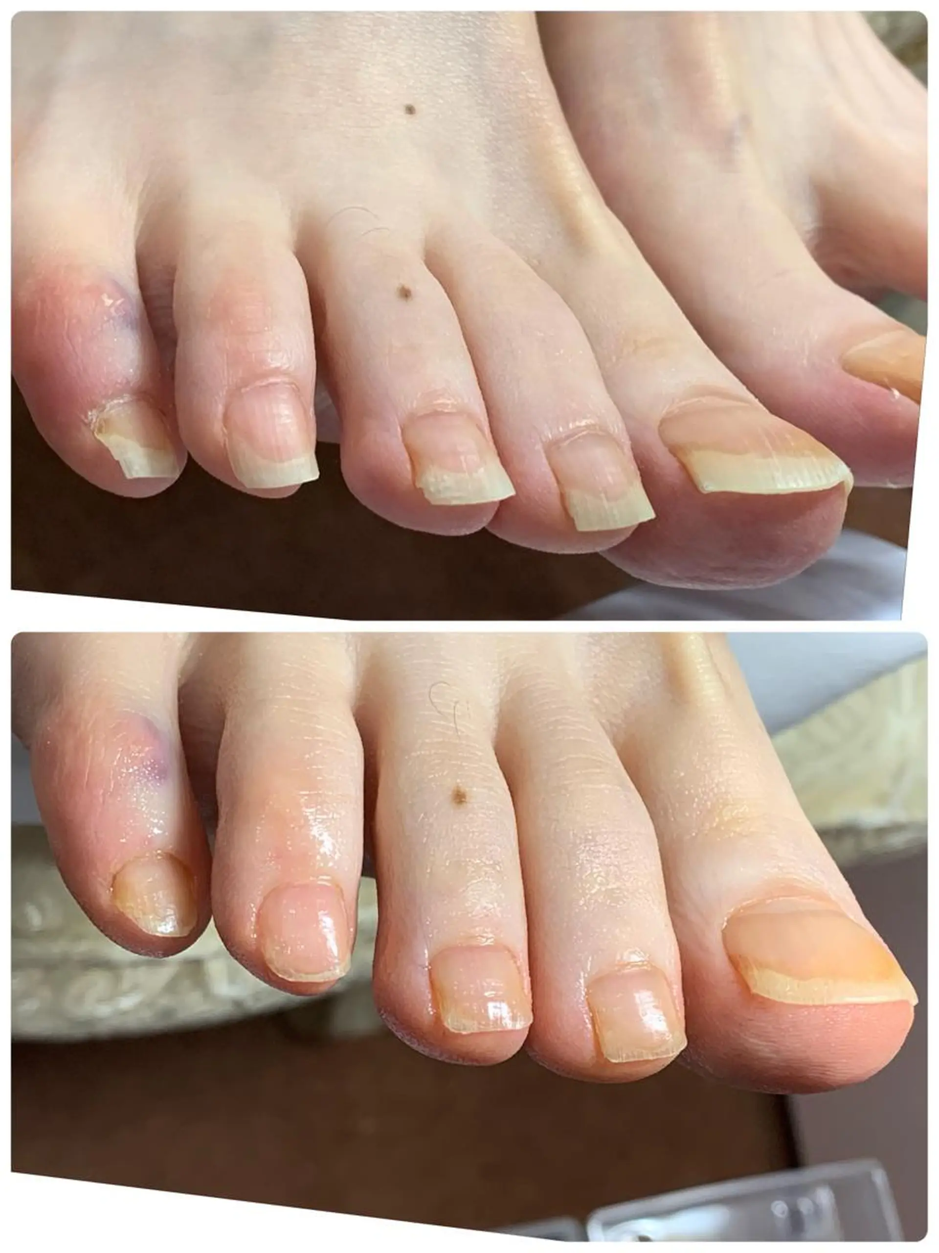 ネイル メンズトータルビューティーwellnessMARCA所属・【メンズ美容】 三浦かえでのネイルデザイン