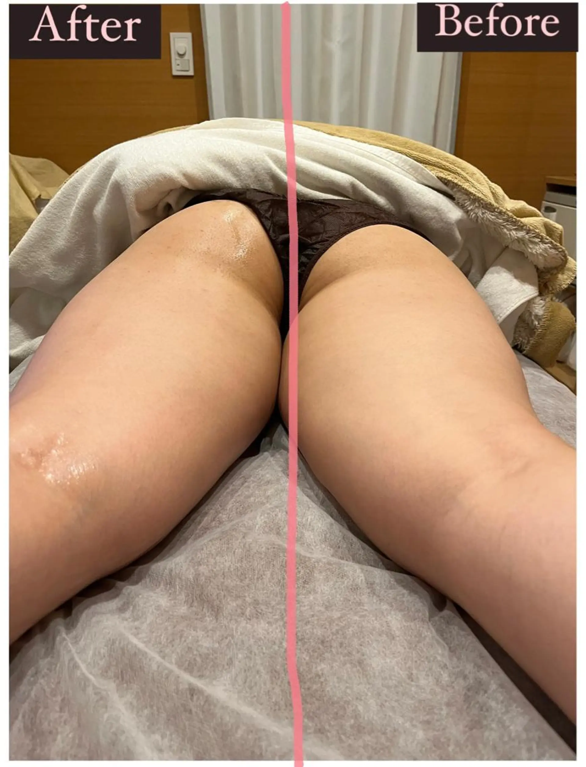 ハーブピーリング専門 muro.のエステ・リラクイメージ