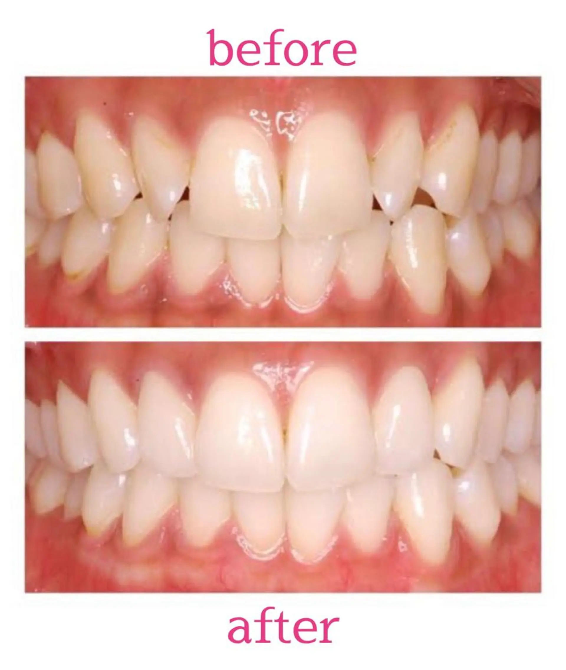 朝倉 香織のマツエク・マツパデザイン