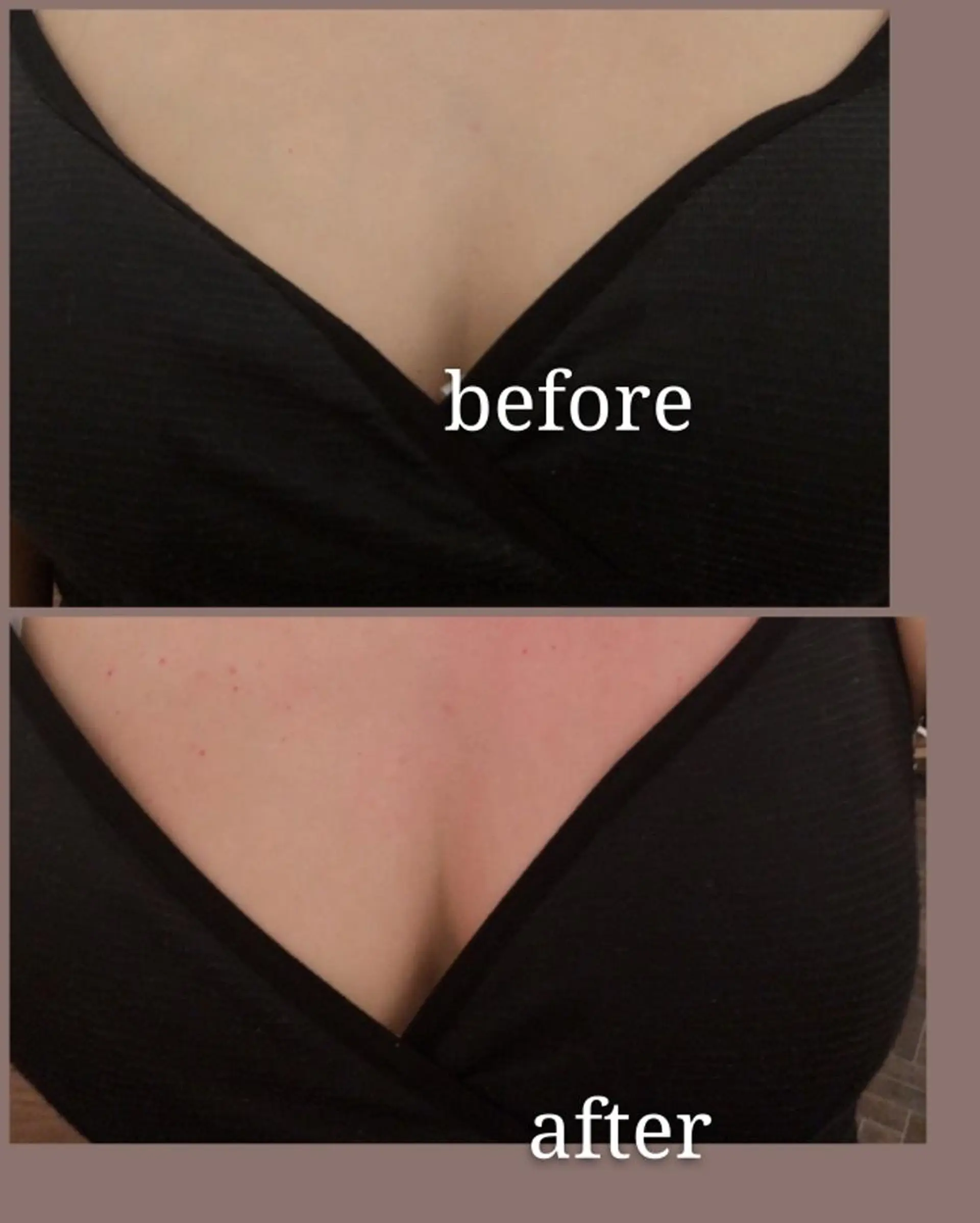 🅖🅤🅩🅔🅛 salonのエステ・リラクイメージ