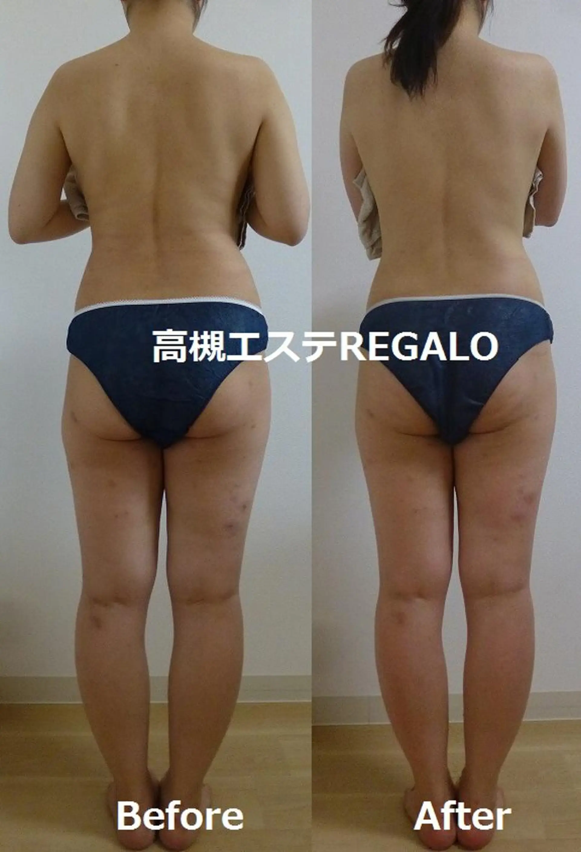 エステ REGALO所属・矢野 さやかのエステ・リラクイメージ