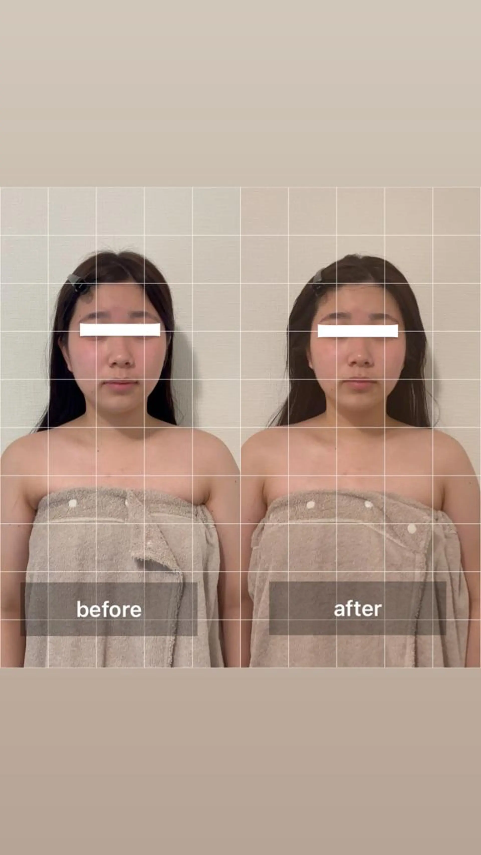 Eclavie所属・エクラヴィ 小顔・エイジングケアのエステ・リラクイメージ