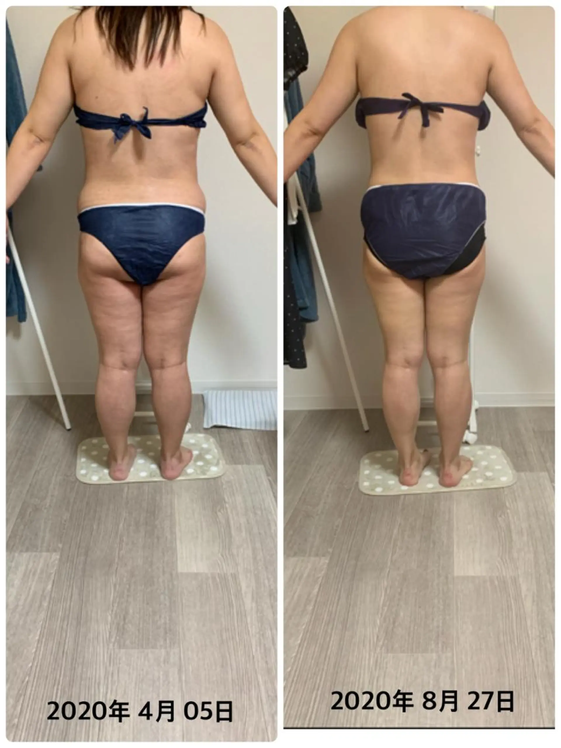 美ボディメイクサロン　only one body所属・所沢 痩身エステサロンのエステ・リラクイメージ