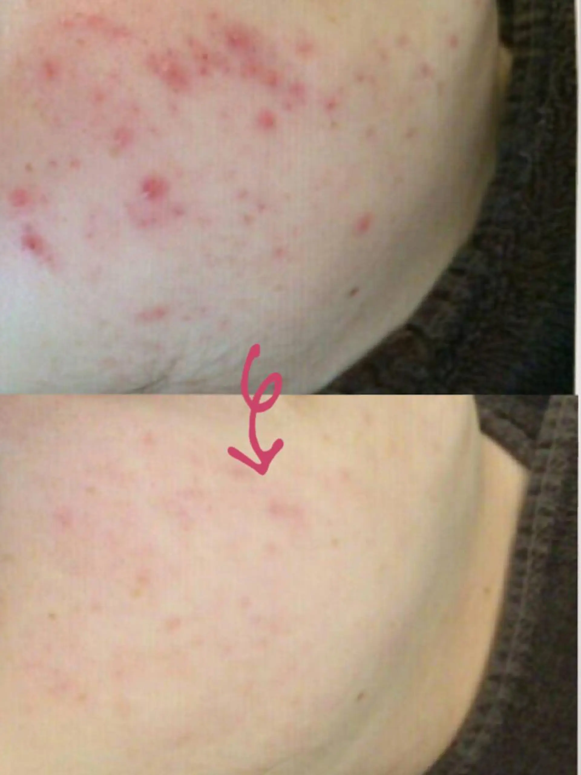 痩身リンパダイエット 隠れ家サロンチャームのエステ・リラクイメージ