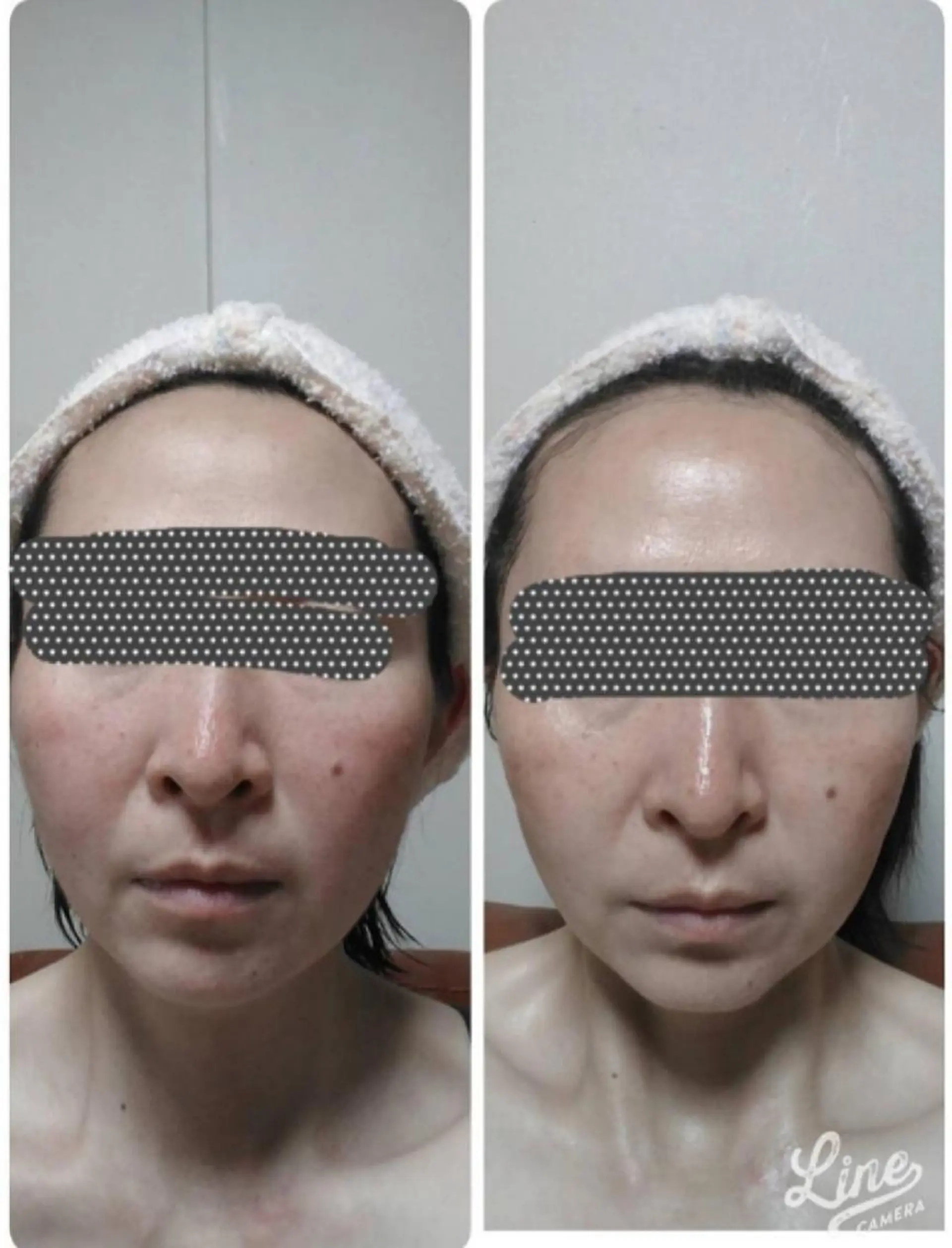 エステ Anabel所属・東 利恵のエステ・リラクイメージ