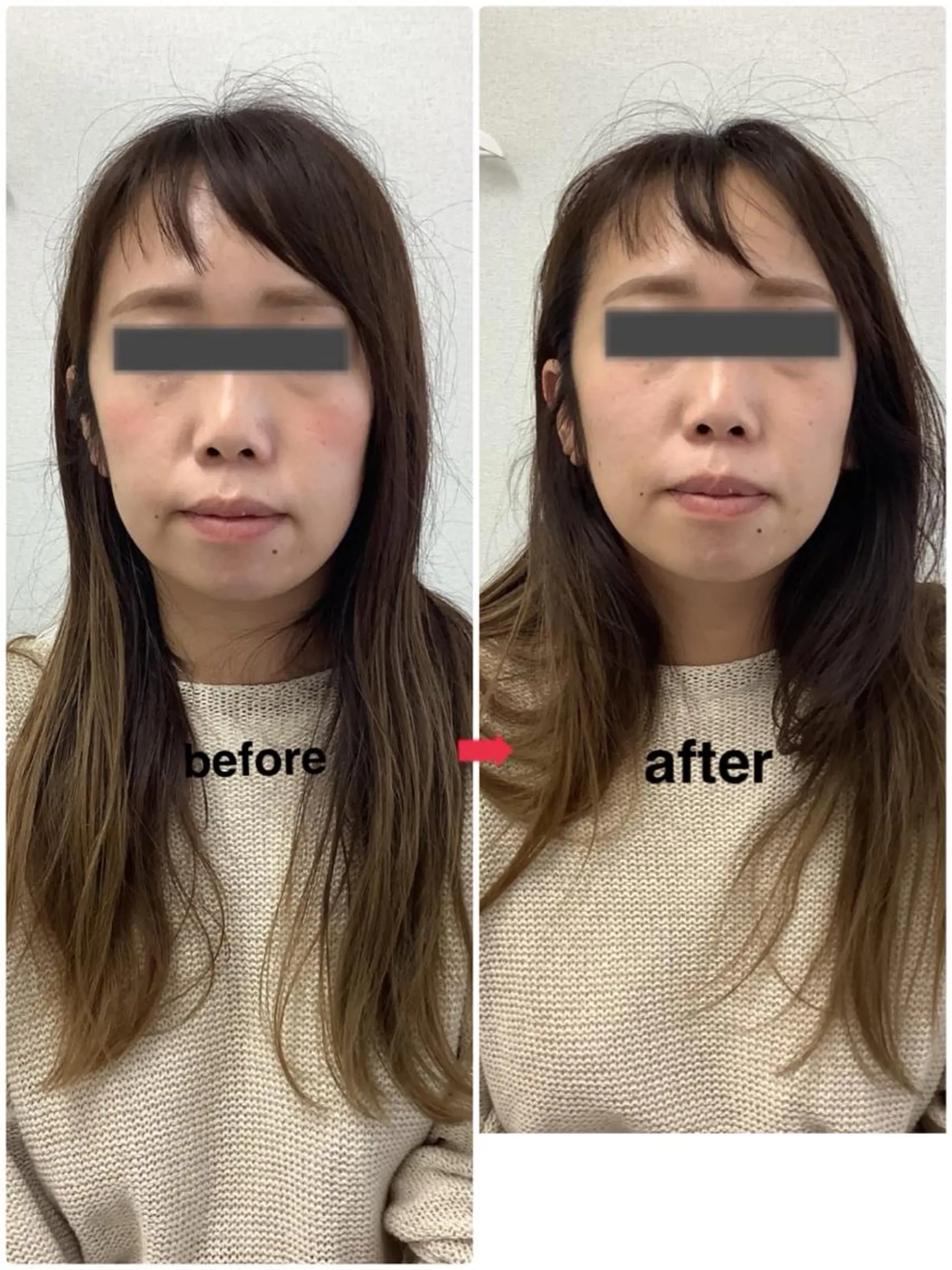 メディカルサロンドオフ所属・ハリサロンドオフ 美容鍼灸×小顔整体のエステ・リラクイメージ