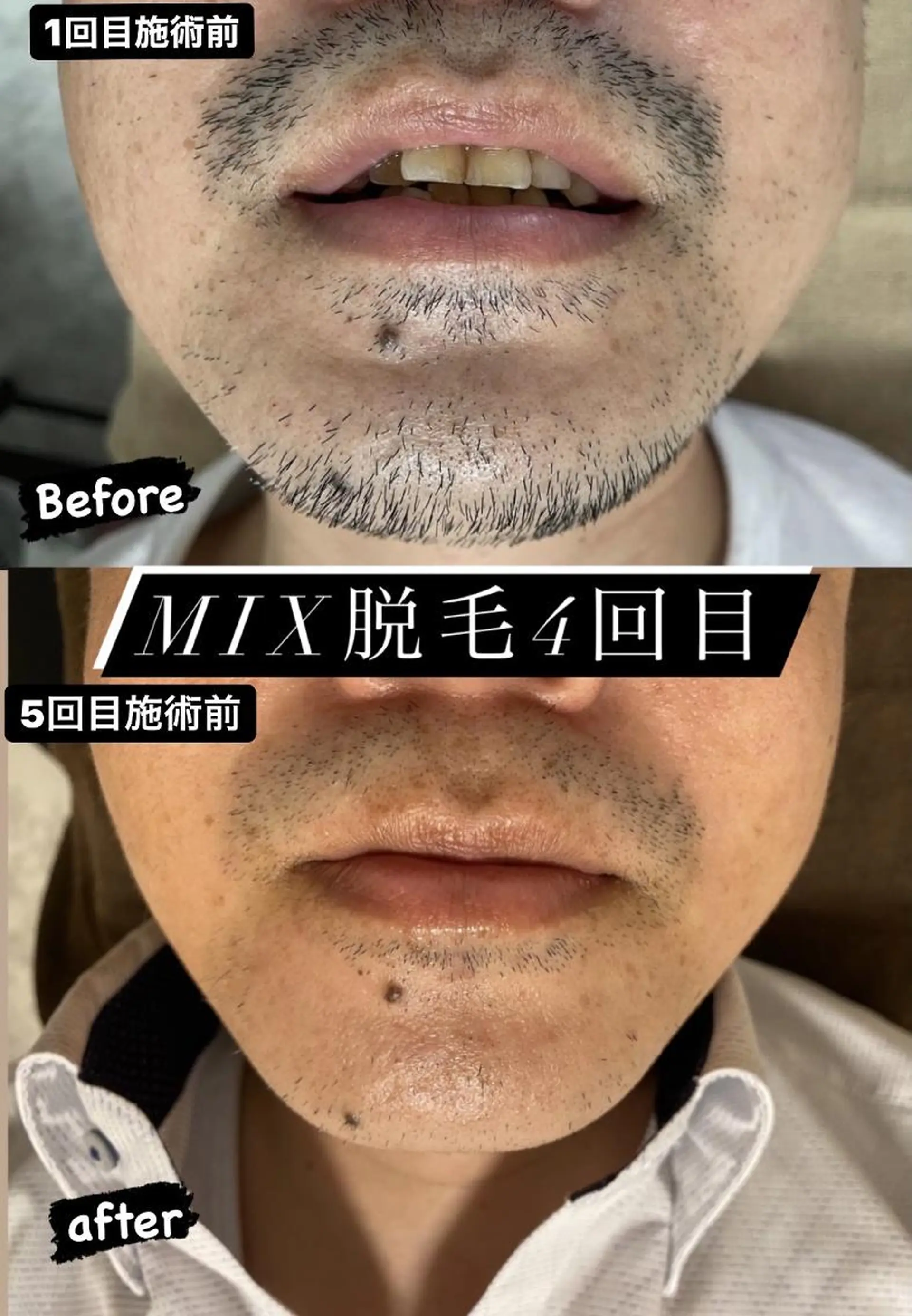 メンズ 脱毛 Epina 千葉店 【エピナ】のエステ・リラクイメージ