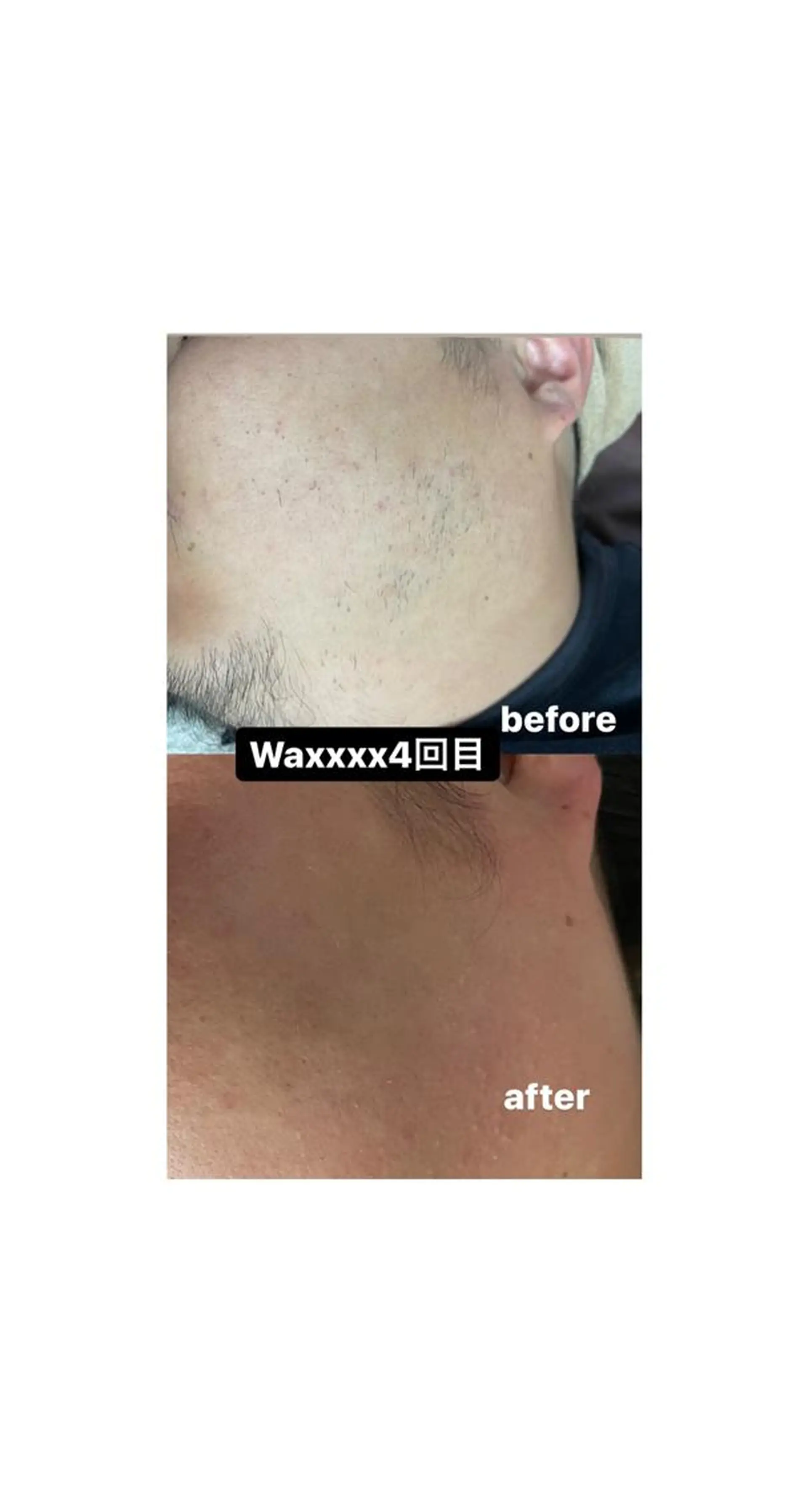 メンズ Epina 千葉店 【エピナ】のエステ・リラクイメージ