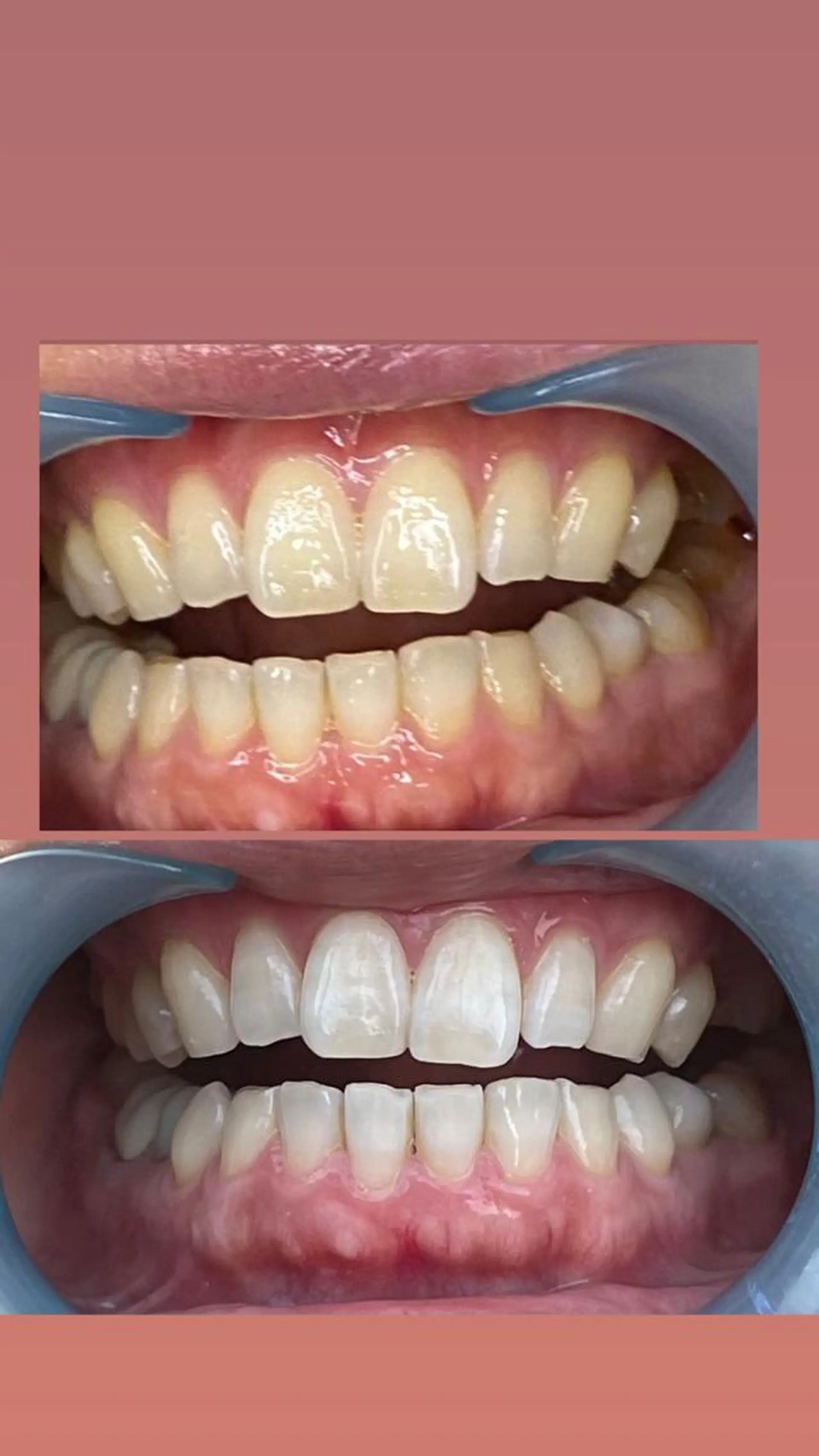 LAVISH nail salonのネイルデザイン