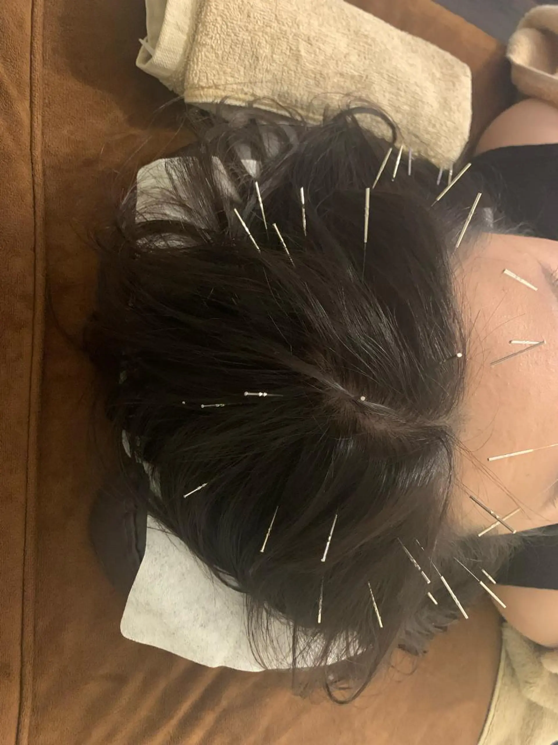 表参道鍼灸院K 美容鍼🔮ララピールのエステ・リラクイメージ