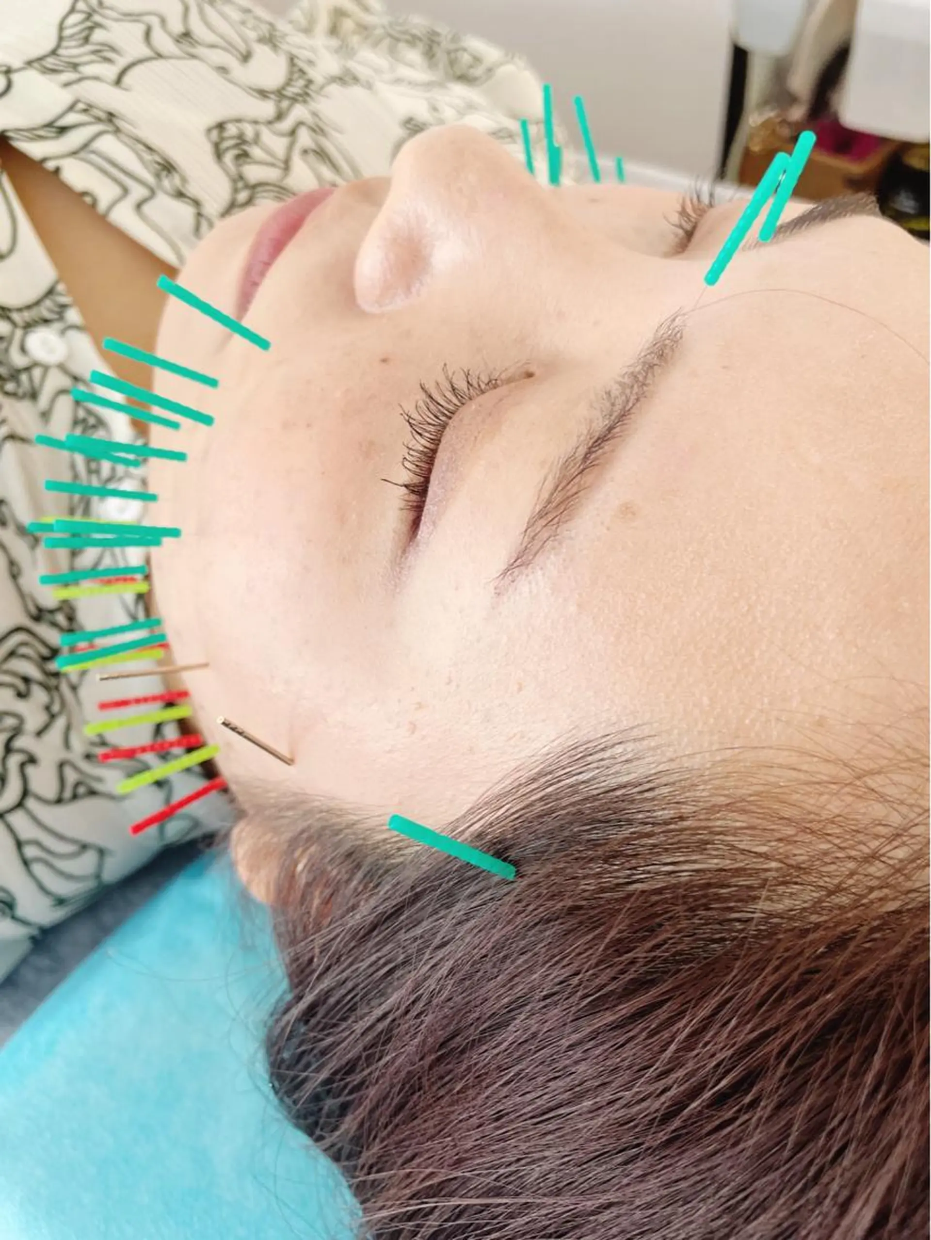 小顔美容鍼専門サロン 渋谷YZのエステ・リラクイメージ