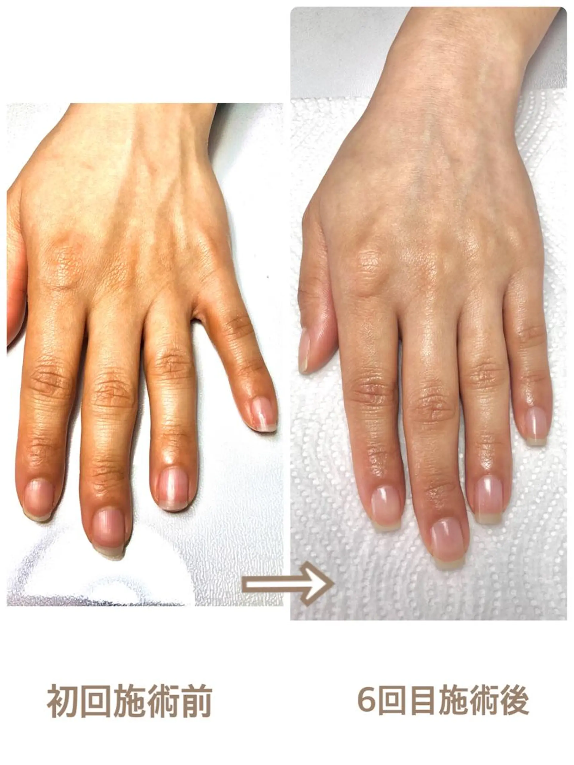 ネイル ハンドケア プライベートネイルサロンPause(ポーズ)所属・自爪育成ネイルサロン Pause(ポーズ)のネイルデザイン