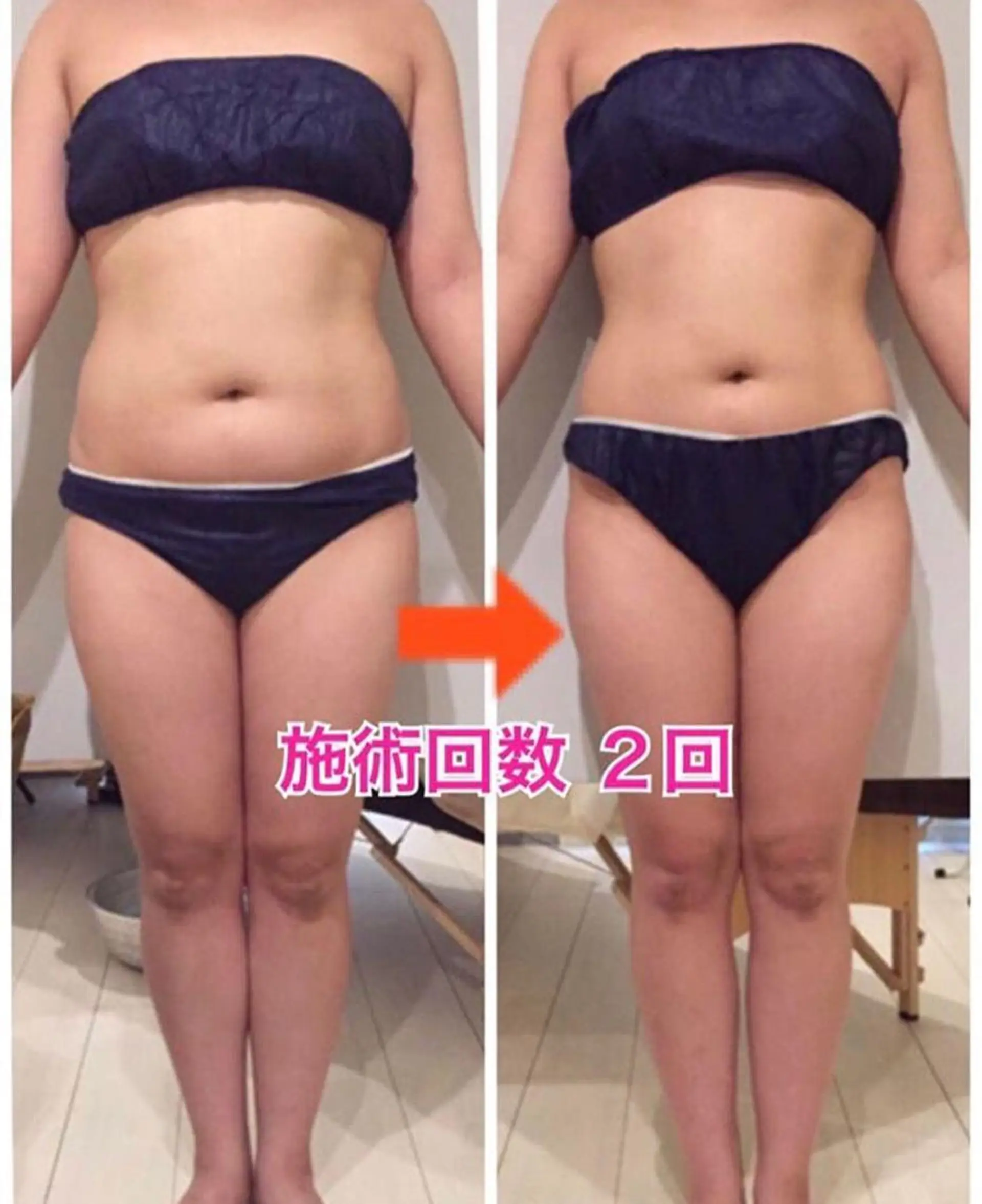 ショート カラー パーマ ヘアアレンジ メンズ キッズ ネイル マツエク・マツパ 痩身&ボディ 結果出し🌟丹野のエステ・リラクイメージ