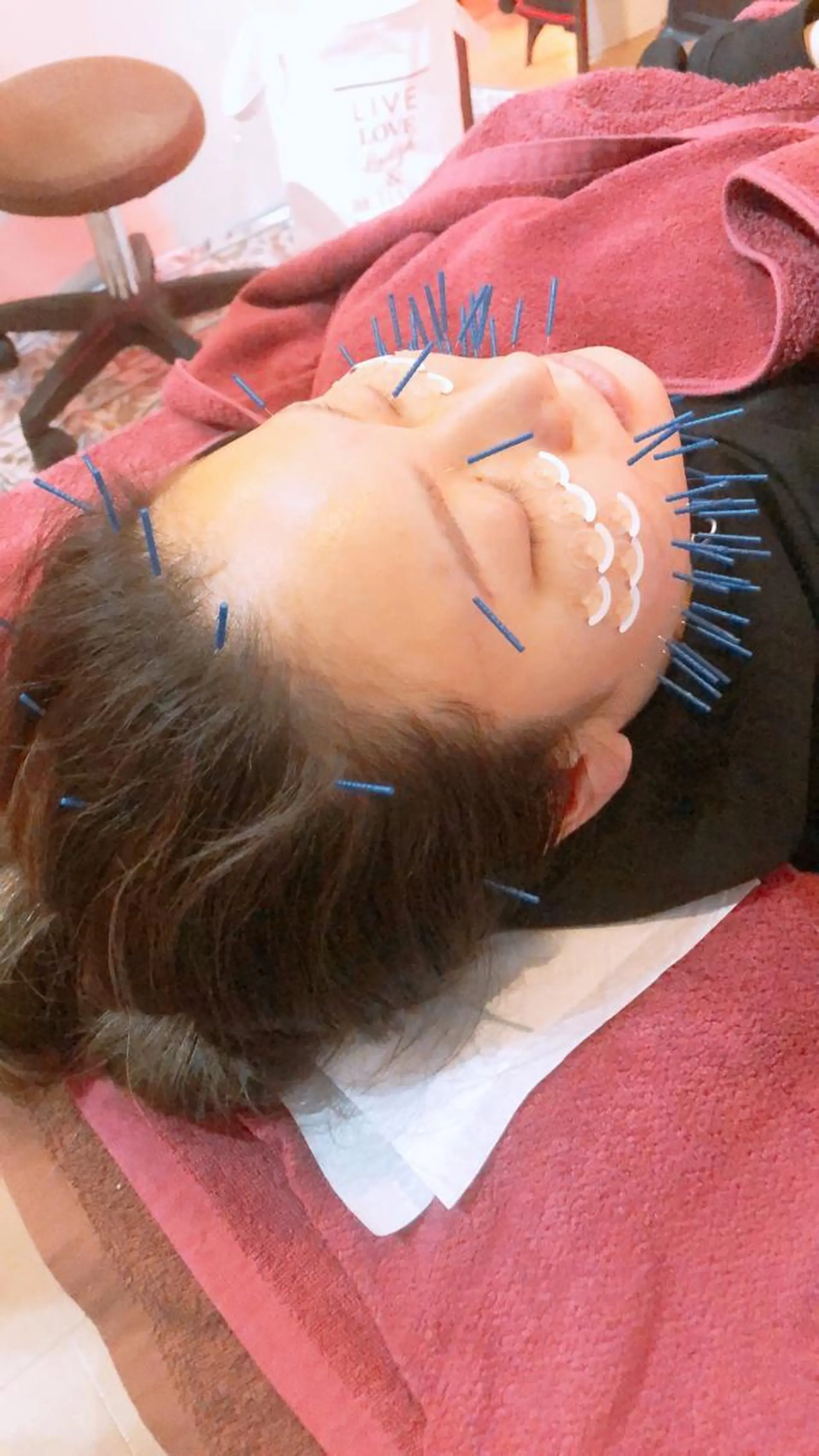 エステ リラク 美容鍼灸女性専用 りんご鍼灸治療院のエステ・リラクイメージ