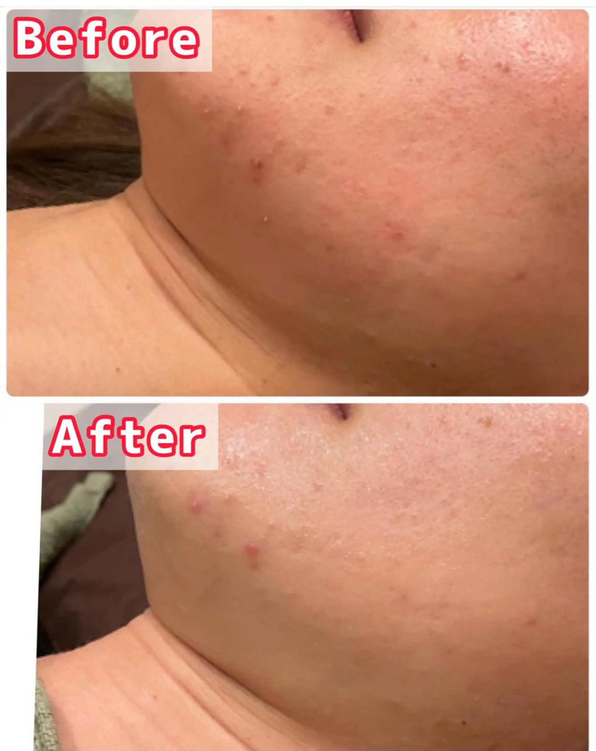 ハーブピーリング専門 muro.のエステ・リラクイメージ