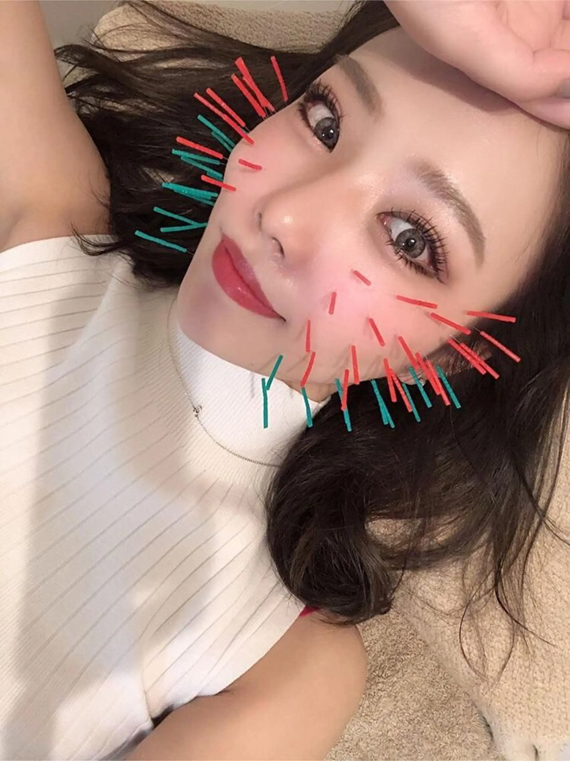 鍼灸整骨院Refine所属・鍼灸 Refineのその他イメージ