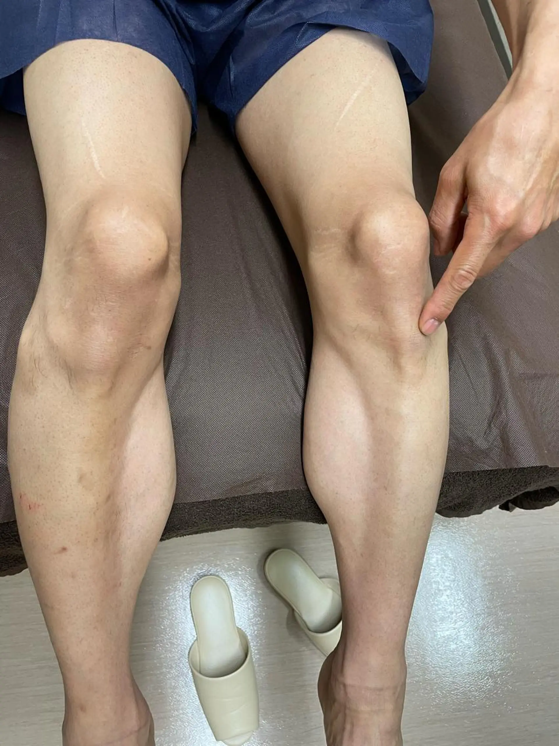 メンズ 脱毛 メンズビューティー 池村哲雄のエステ・リラクイメージ