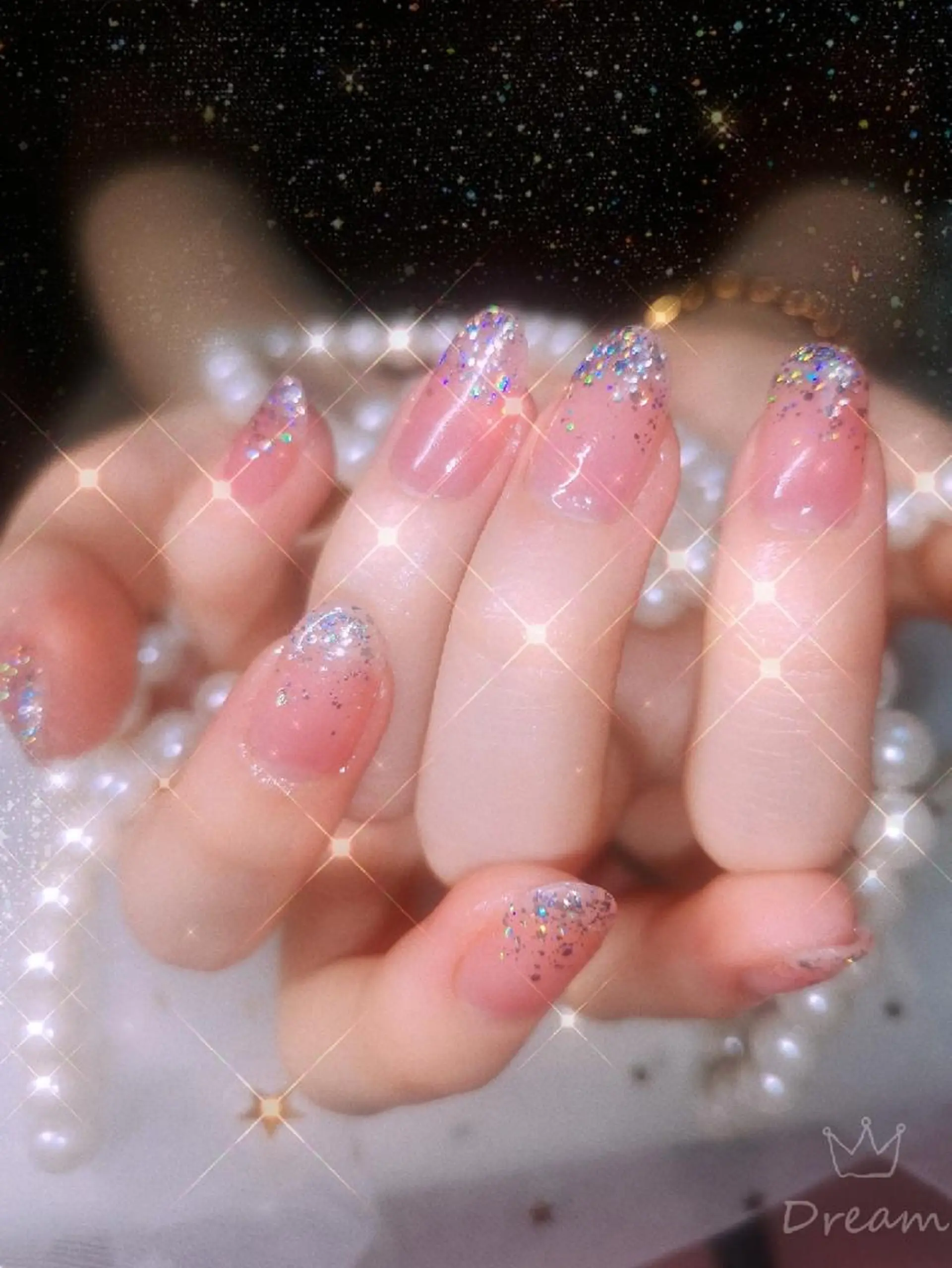 ミディアム ネイル ハンドネイル ネイリストゆか💅 長さだし、深爪矯正のネイルデザイン