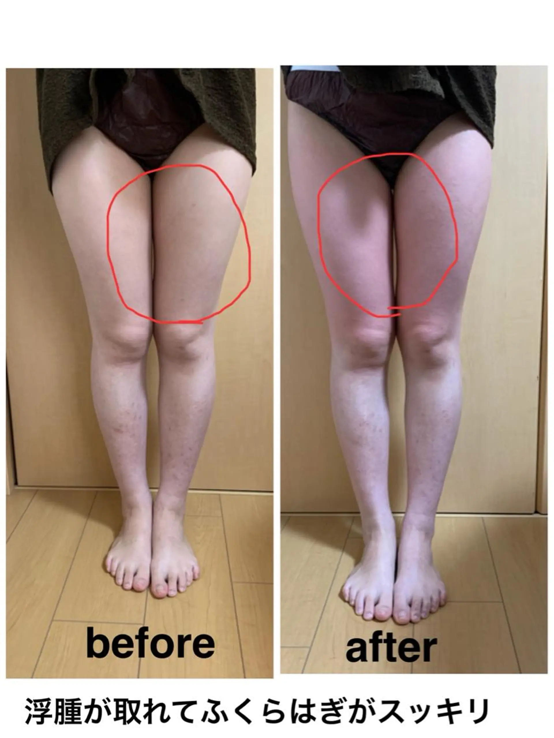 エステ リラク 痩身/脱毛/ネイル HARUKAのエステ・リラクイメージ