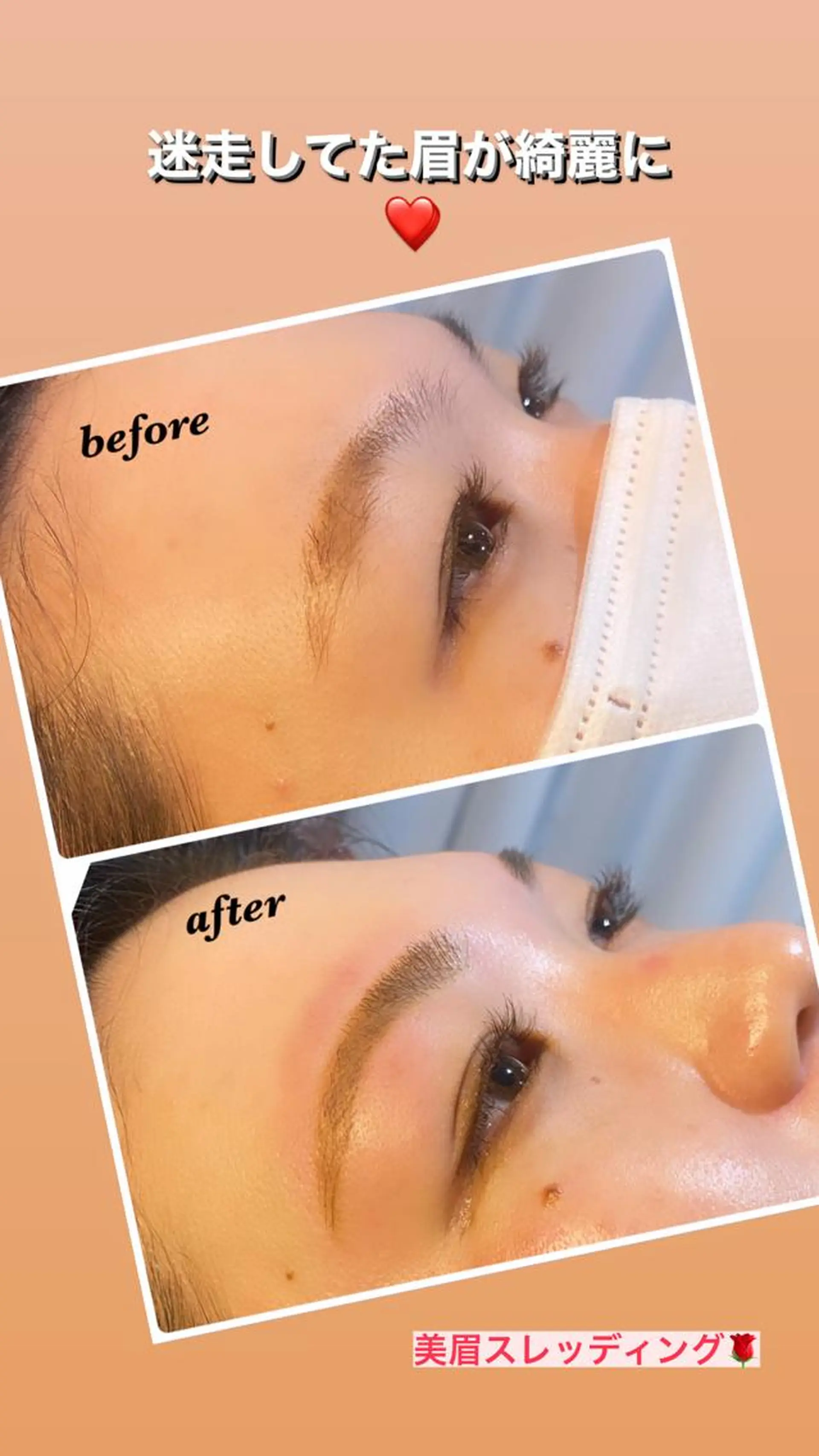 アイブロウ ハーブピーリング/韓国肌管理/フェイシャル/毛穴洗浄/眉毛/顔脱毛【糸脱毛専門】rev所属・ハーブピーリング🌹 毛穴洗浄❤️眉waxのエステ・リラクイメージ