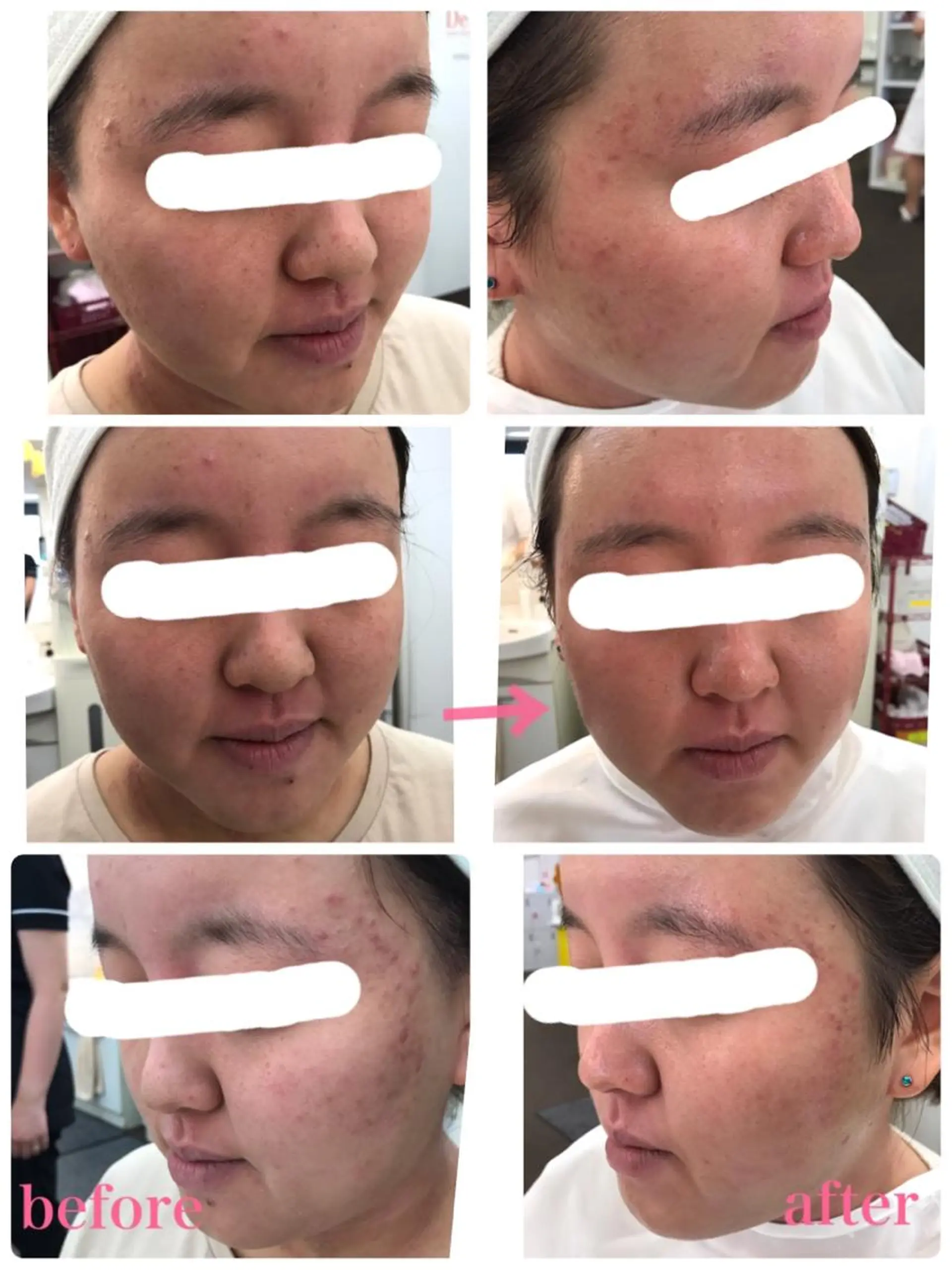 デ・アイム　あべのルシアス店所属・水野 真理◡̈*のエステ・リラクイメージ