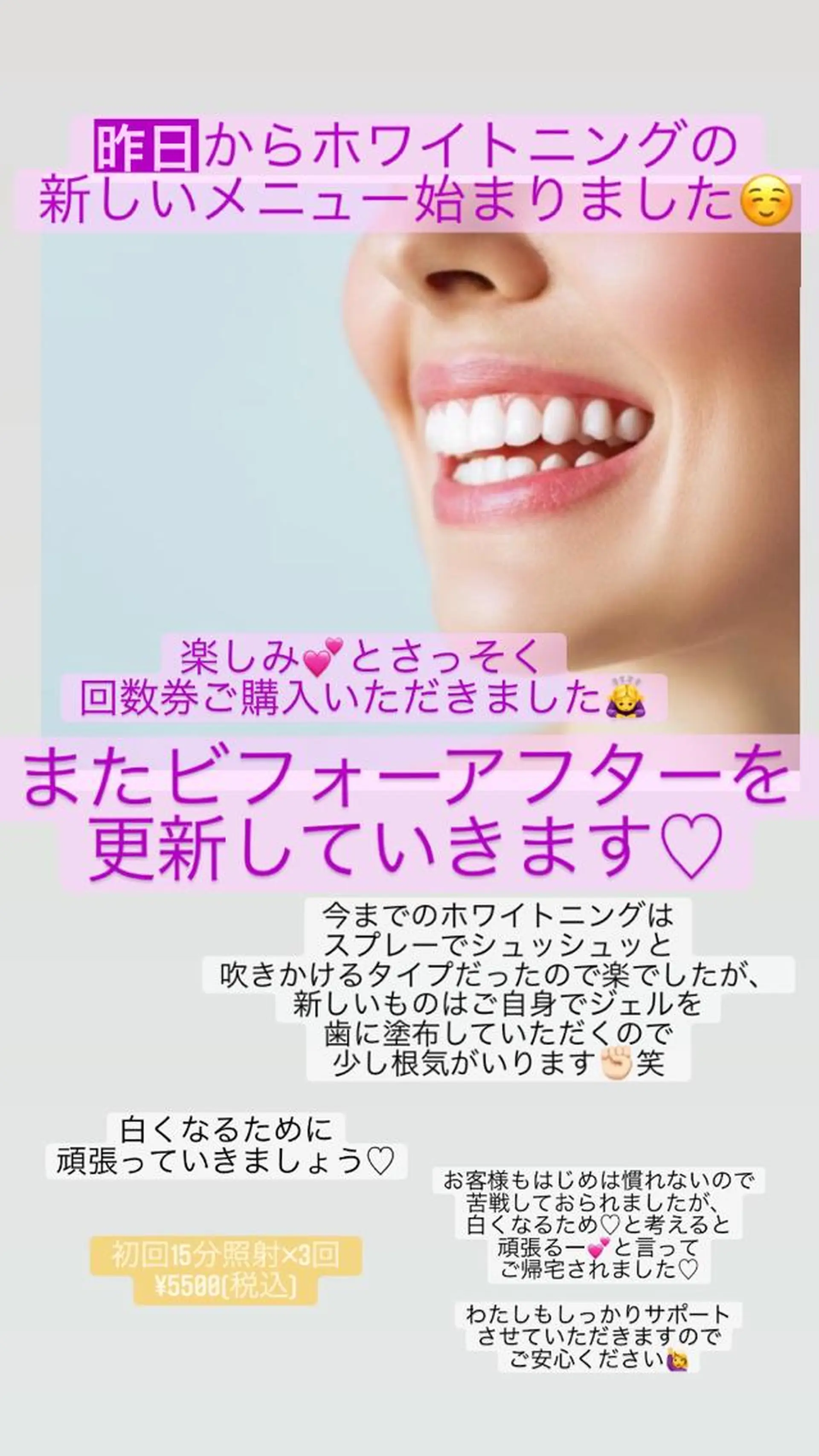 ネイル ホワイト ネイル/耳つぼ /新ホワイトニングのネイルデザイン