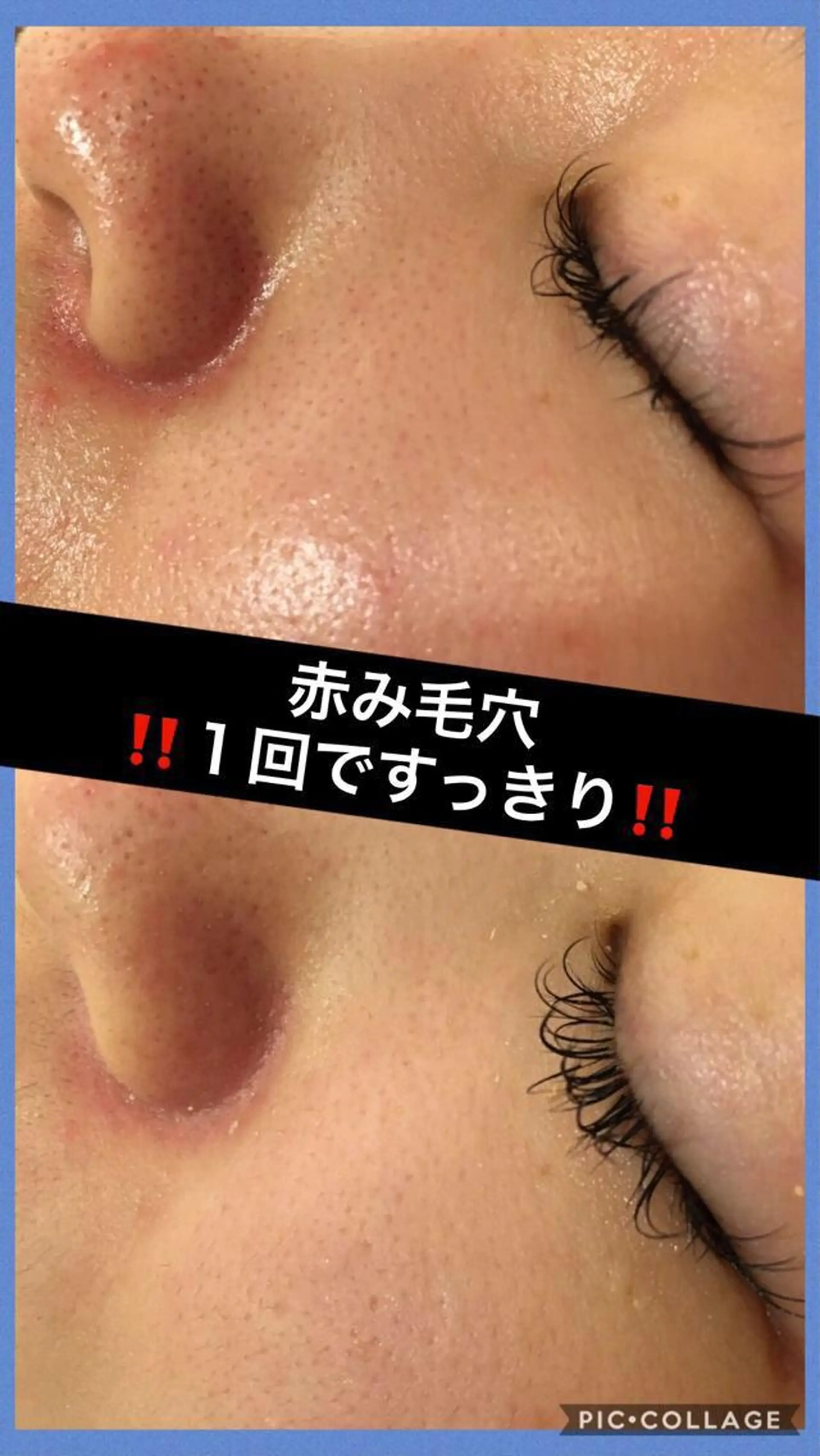 ミディアム カラー パーマ ヘアアレンジ メンズ キッズ ネイル マツエク・マツパ ニキビ・肌質改善専門 ♡人生が変わるサロンのエステ・リラクイメージ