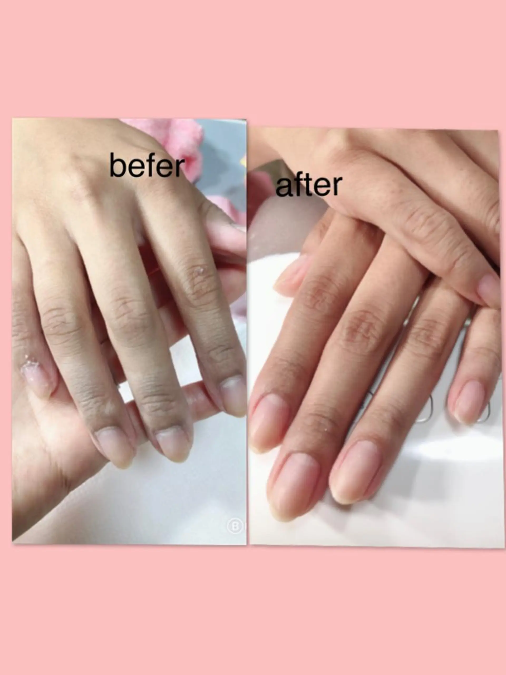 ネイル 北浦和 自爪育成ケアのネイルデザイン