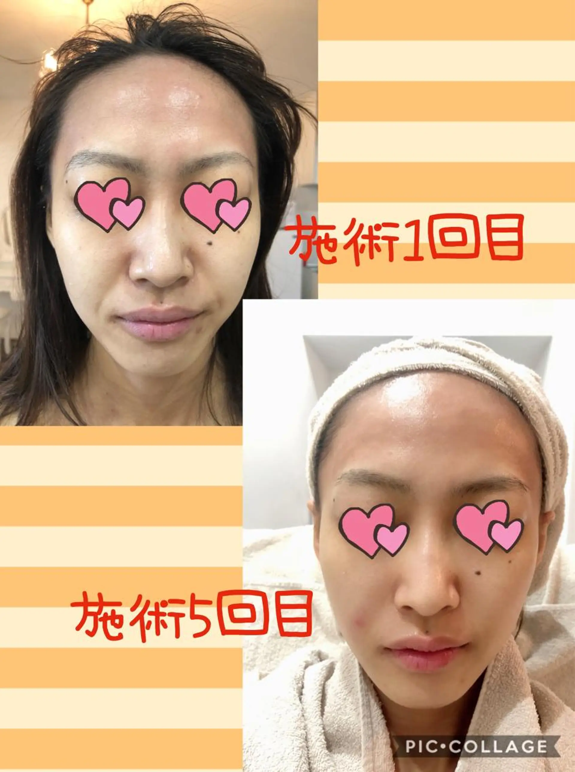 まつ毛パーマ・美肌 ナチュラル　ボーテのマツエク・マツパデザイン