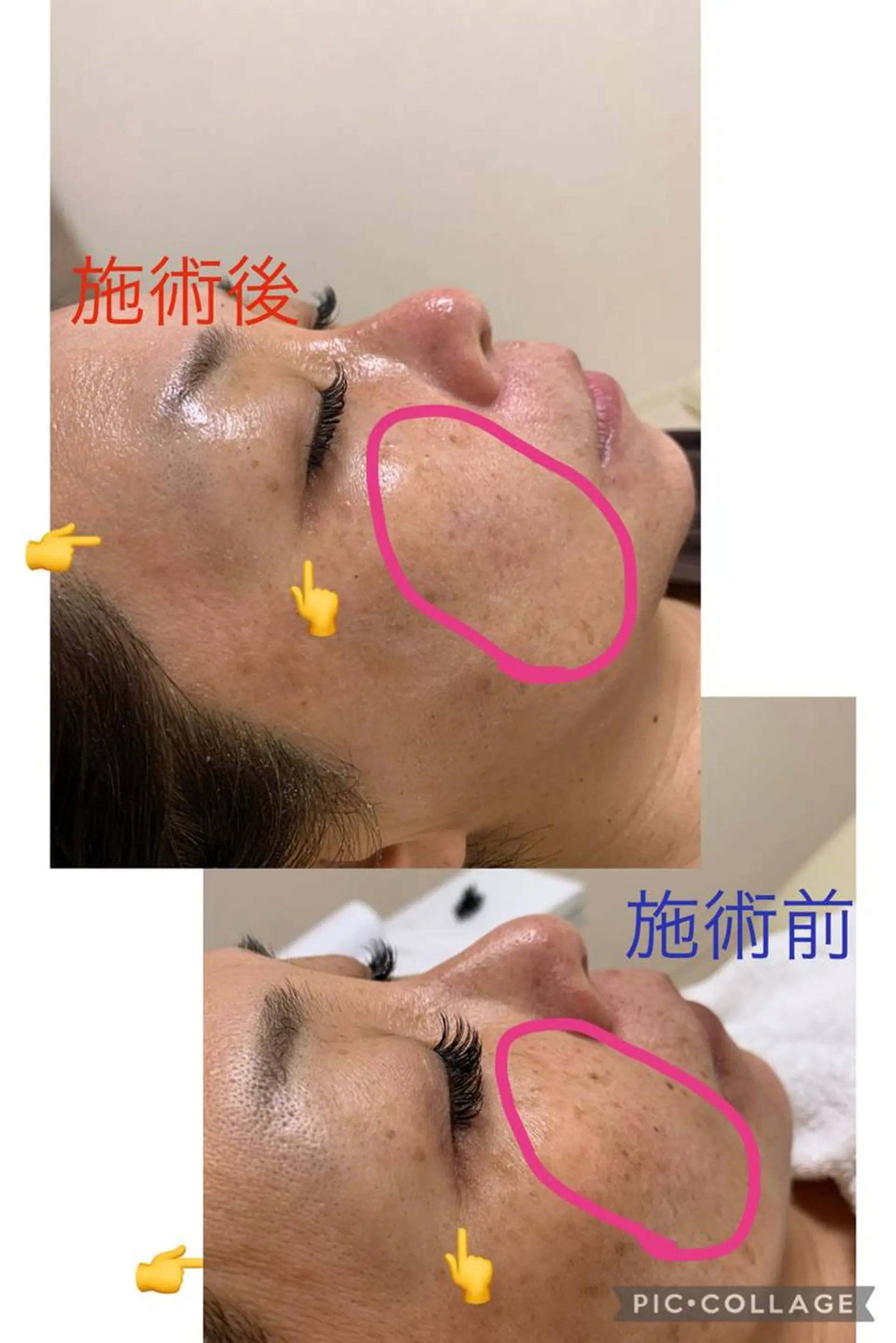 Lino Uのネイルデザイン