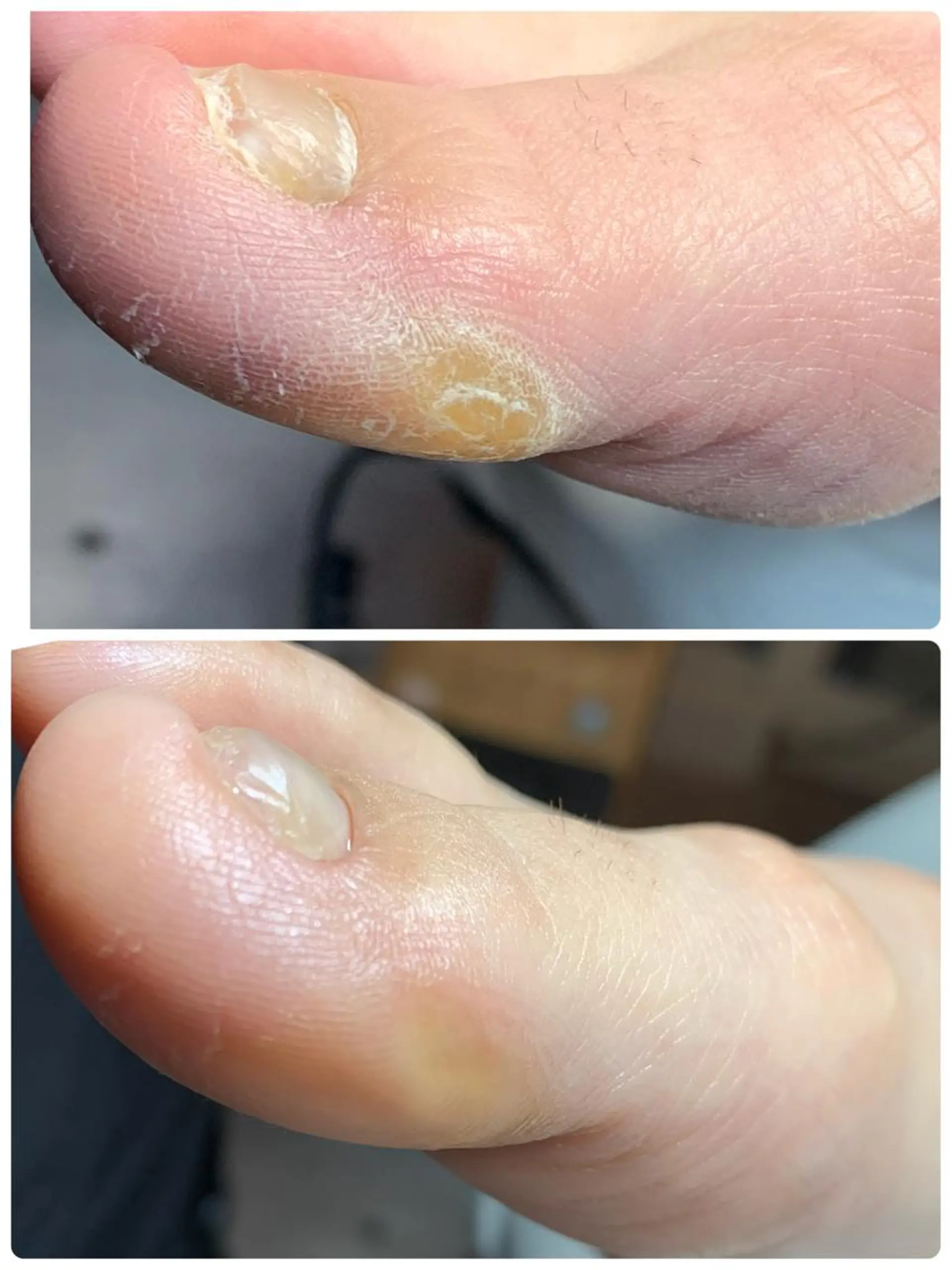 ネイル フットネイル メンズネイル メンズトータルビューティーwellnessMARCA所属・【メンズ美容】 三浦かえでのネイルデザイン