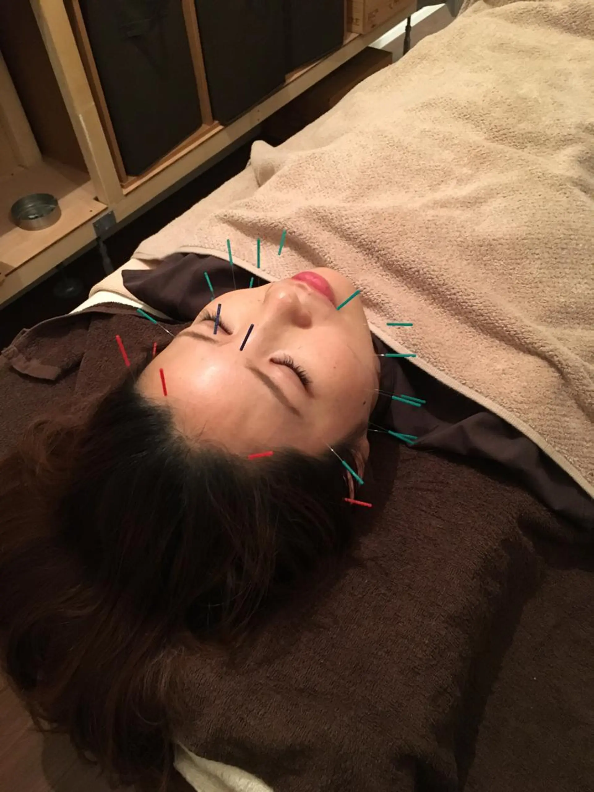 【パーソナル鍼灸】 Pintのエステ・リラクイメージ