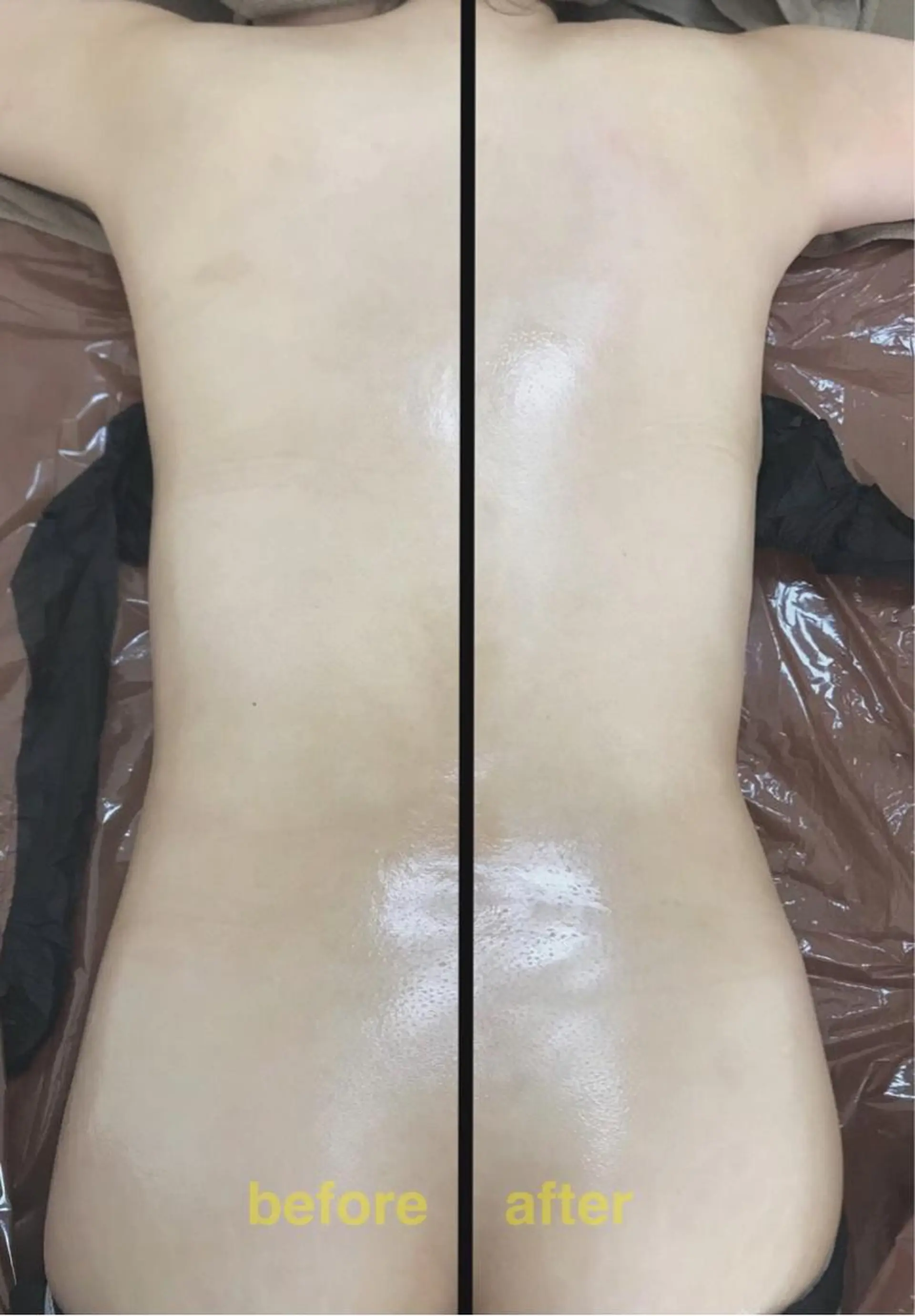 biloop所属・《痩身×疲労改善》 BILOOPのエステ・リラクイメージ