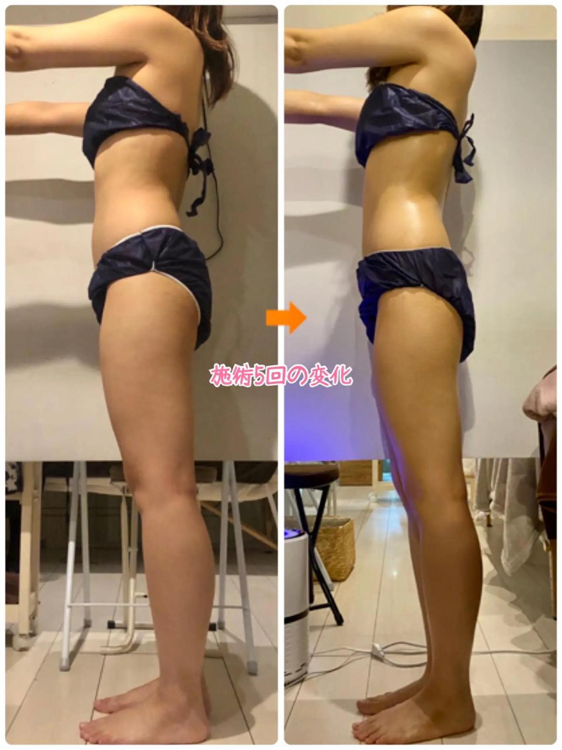 ショート カラー パーマ ヘアアレンジ メンズ キッズ ネイル マツエク・マツパ エステ リラク ‍痩身＆ボディ 結果出し🌟丹野のエステ・リラクイメージ