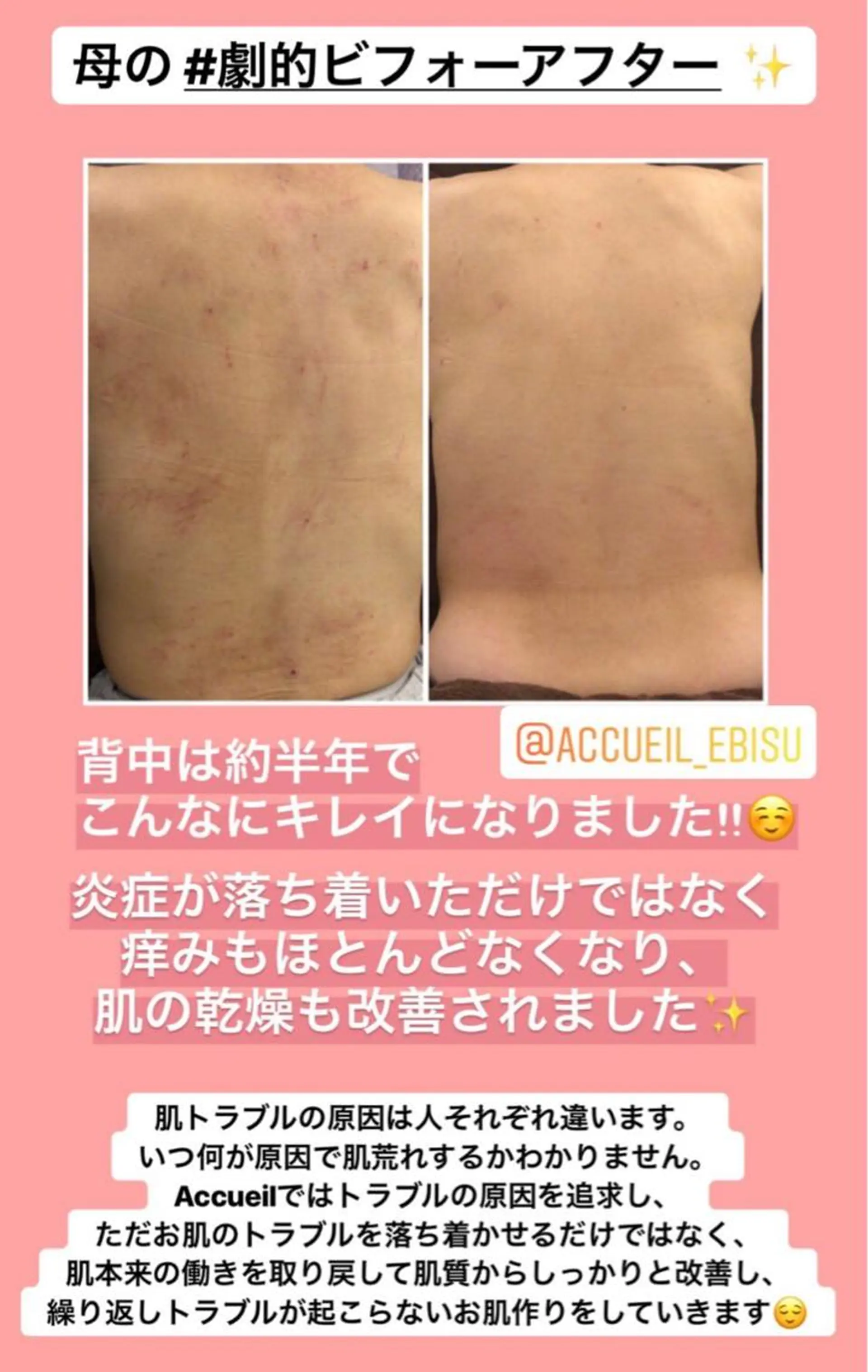 ミディアム カラー パーマ ヘアアレンジ メンズ キッズ ネイル マツエク・マツパ ニキビ・肌質改善専門 ♡人生が変わるサロンのエステ・リラクイメージ