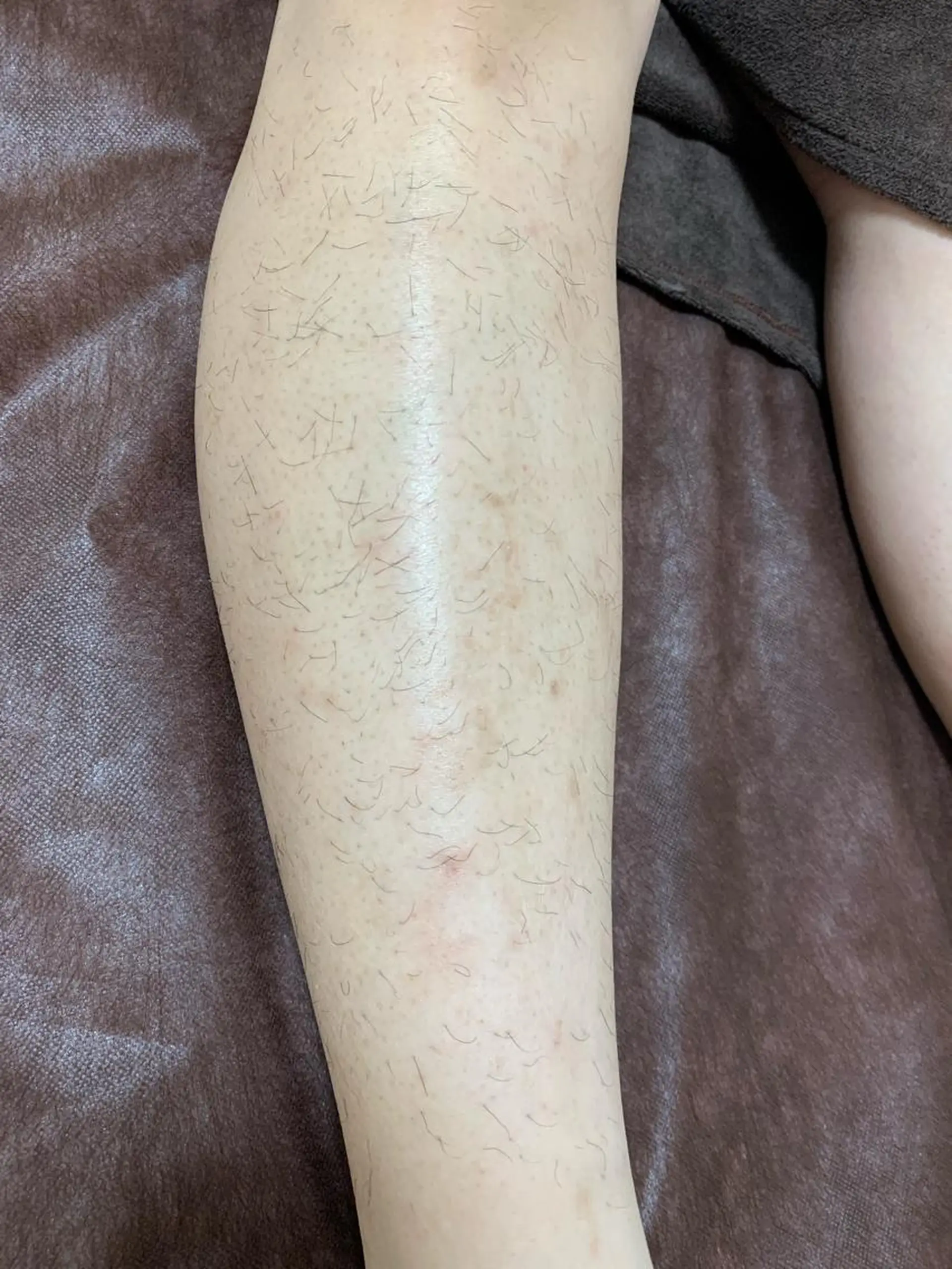 メンズ キッズ 脱毛SALON RaYNiCKのエステ・リラクイメージ