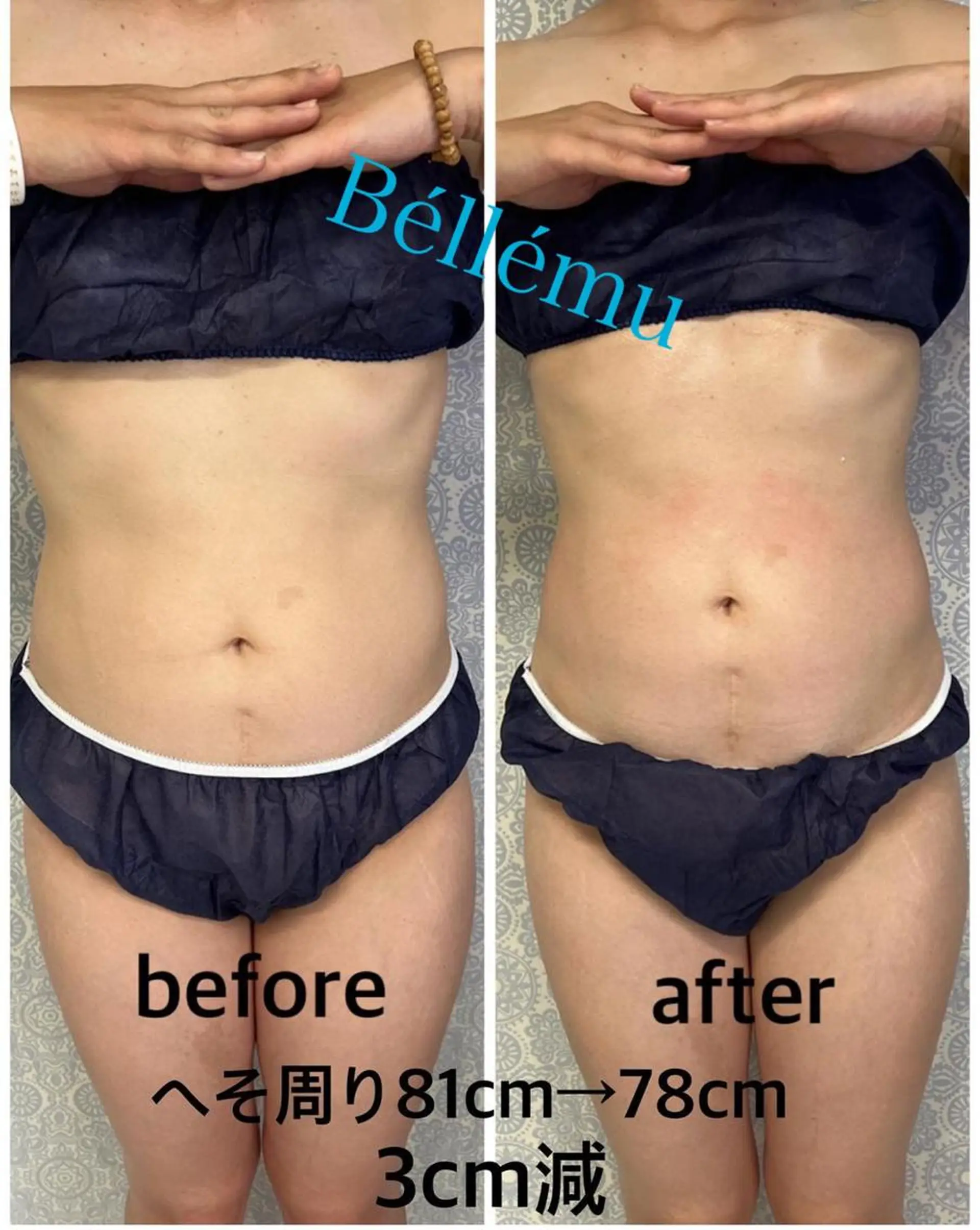 Salon de Béllému所属・Béllému ﾍﾞﾙｴﾐｭ　あおいのエステ・リラクイメージ