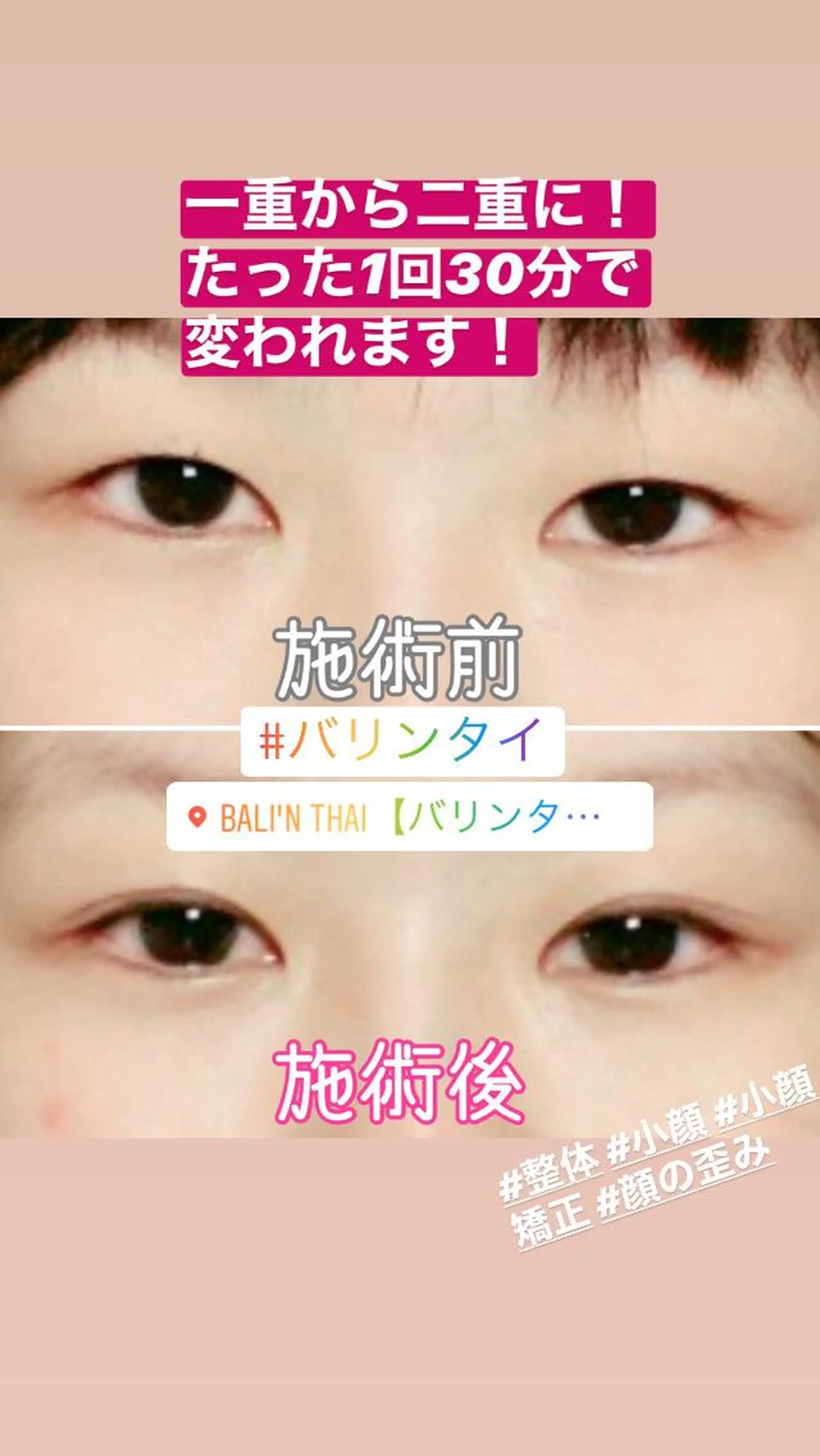 🌈歪み改善🌈 バリンタイ すぎうらのエステ・リラクイメージ