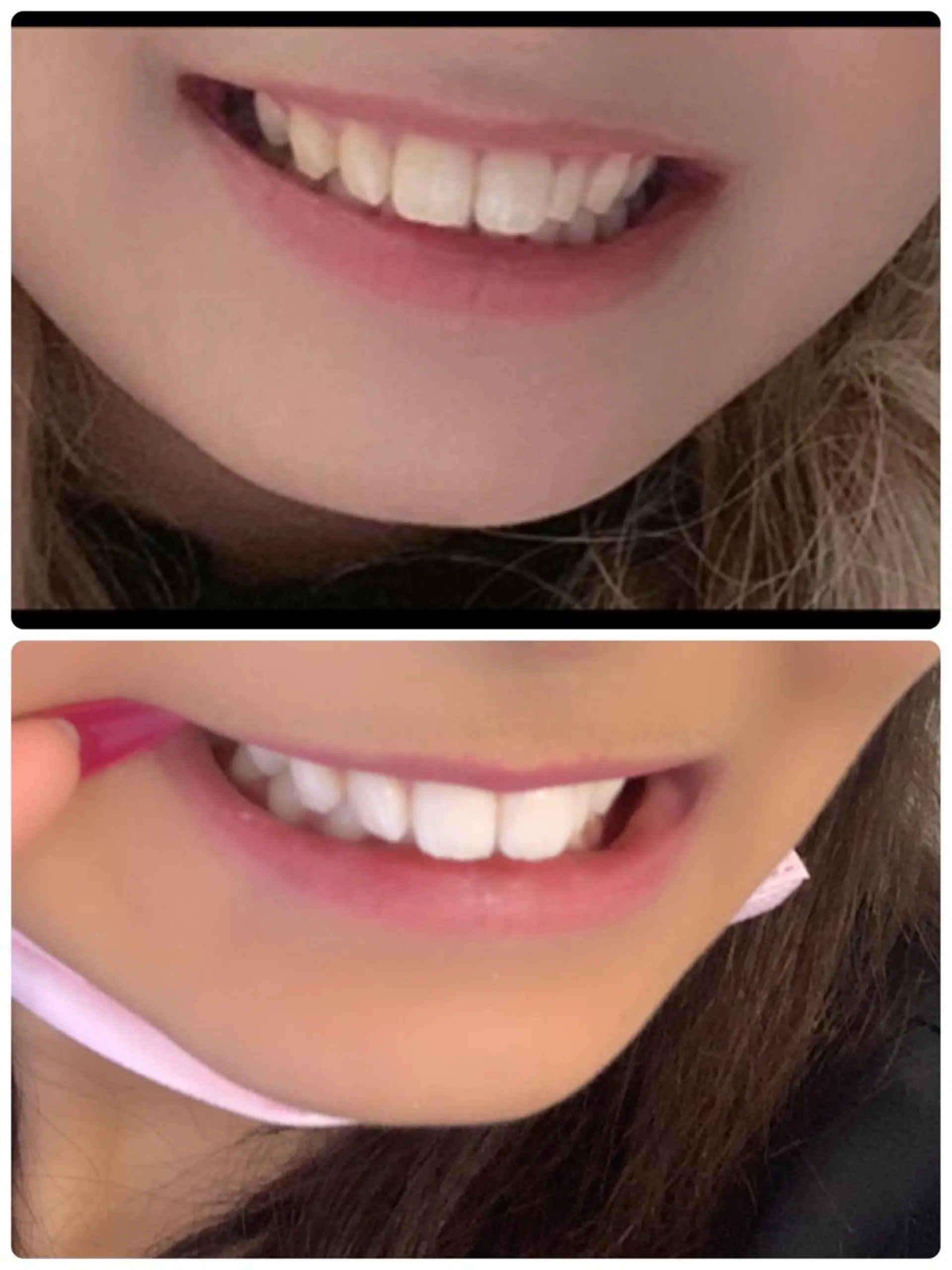 LOVE ホワイトニング渋谷のその他イメージ