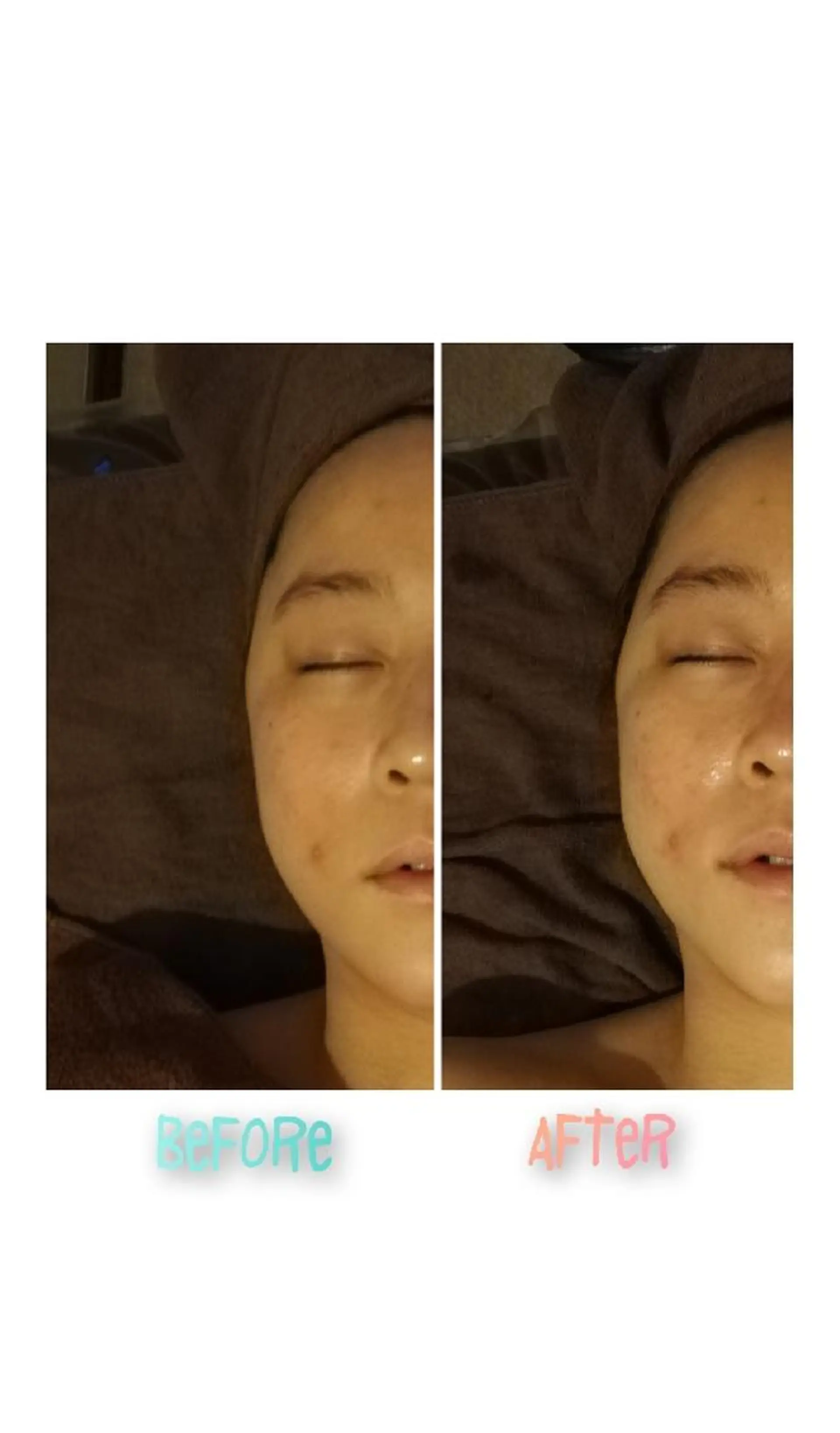 エステ 肌管理専門！BACI 加盟店LUANAのエステ・リラクイメージ