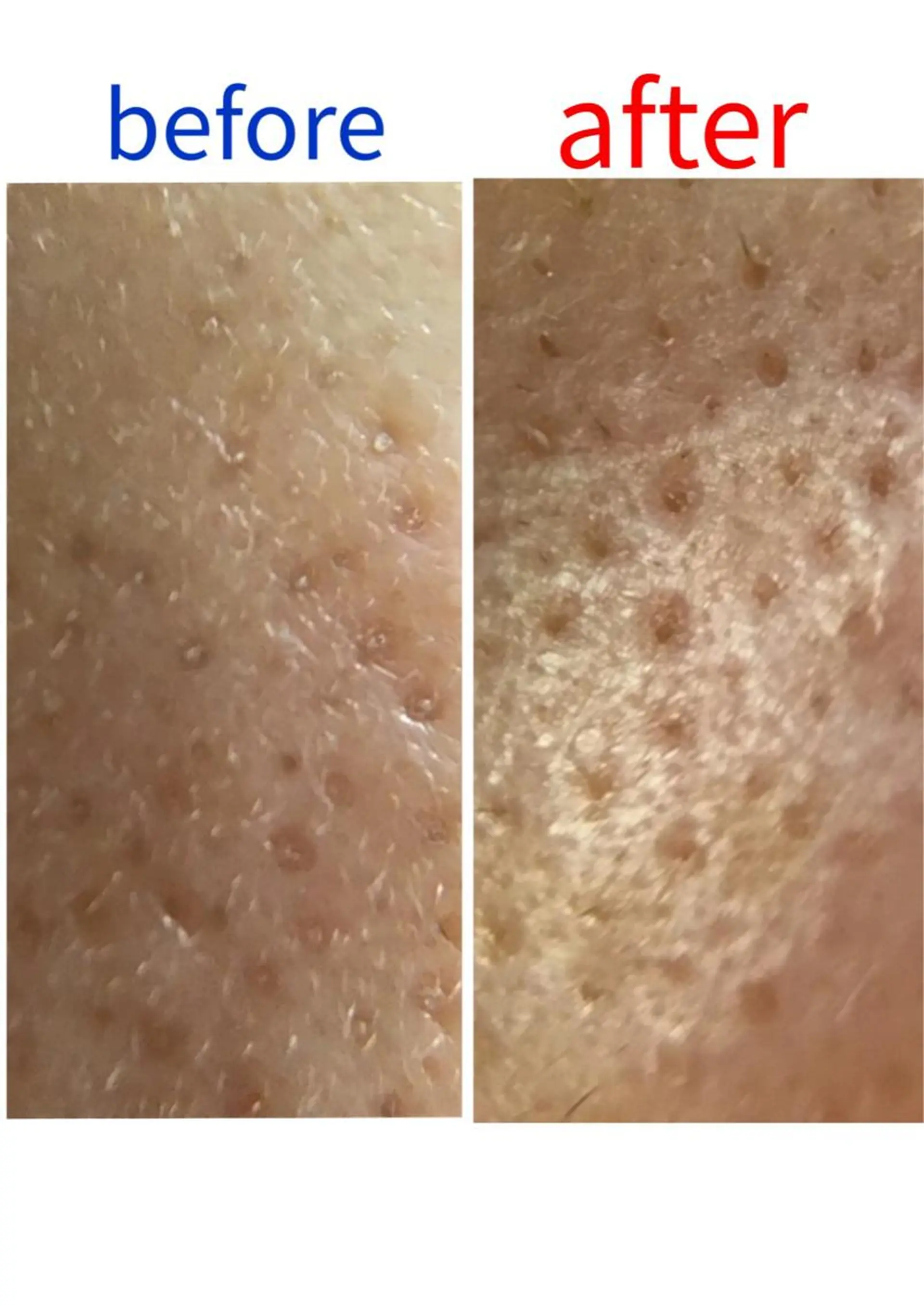 エステ デアイム川口前川所属・エイジング肌質改善 サロンプレジールのエステ・リラクイメージ