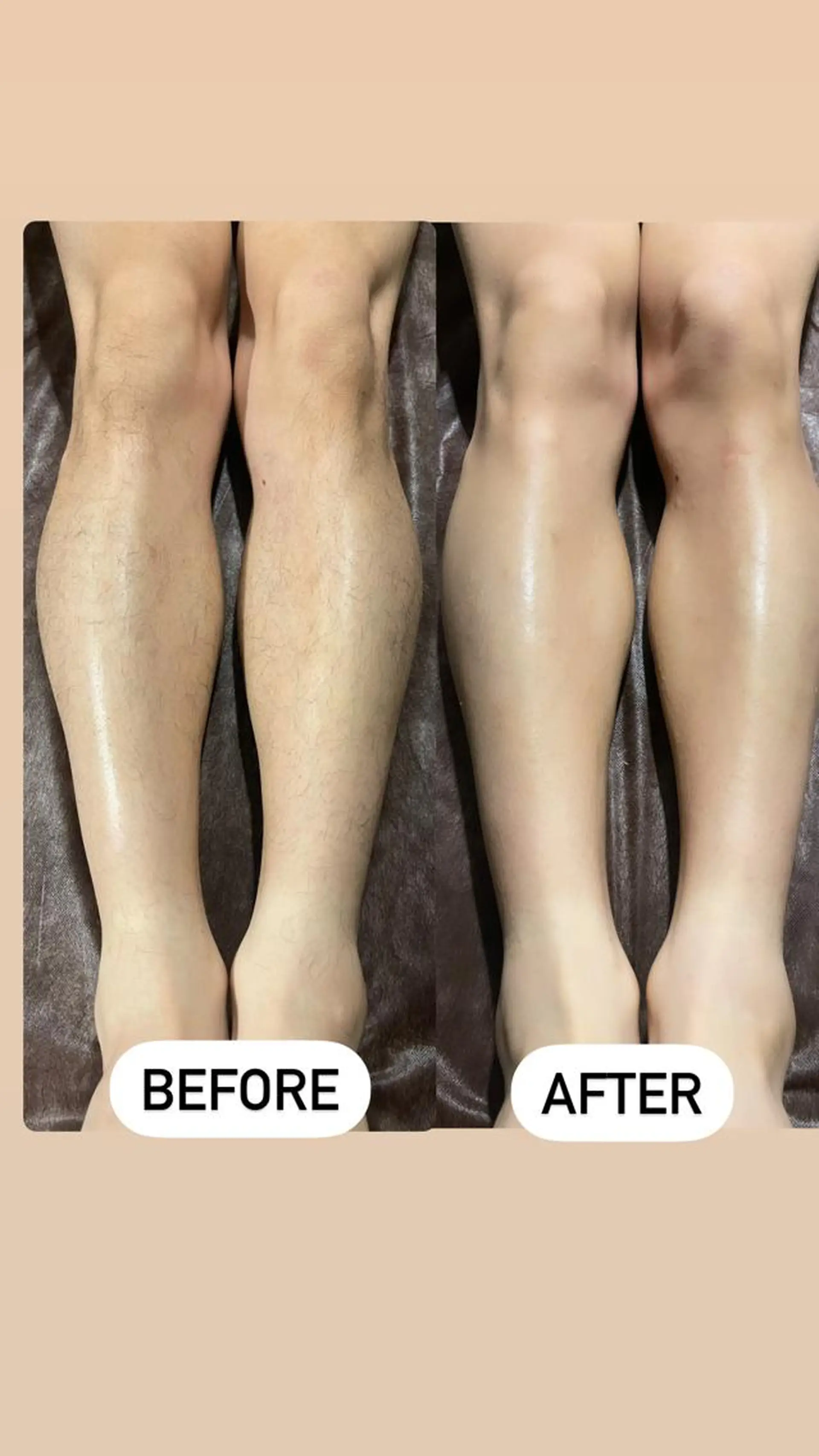 メンズ 脱毛 メンズ眉毛ITSUK Iメンズ専門　新宿の眉毛・アイブロウイメージ